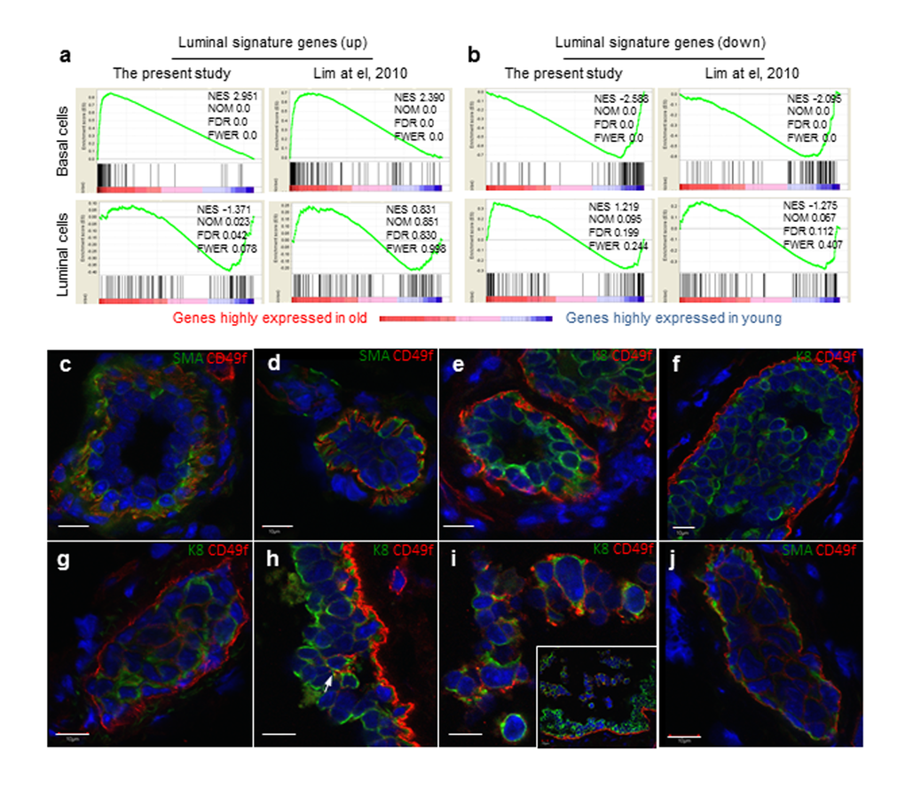 Aged basal cells were enriched with cells expressing luminal gene signature and contains K8+ luminal cells. (a and b) Gene set enrichment analysis. Genes that are expressed in at least one sample (normalized number of reads > 1) were rank ordered according to their fold changes between young (4-6 mon.) and old (30-32 mon.), with genes highly expressed in old cells on the left. Two sets (the present study and that of Lim et al., 2010) of luminal signature genes were analyzed and indicated as black bars in the plots. The luminal cell signature genes were significantly enriched in the old basal cells, and no significant enrichment was seen in young or old luminal cells. NES, normalized enrichment score. NOM, nominal p-value. FDR, false discovery rate. FEWR, familywise error rate p-value. (c-j) Immunostaining of representative mammary ducts from old (26-31 mon., n = 6) C57BL6/J mice showing that basal cells were CD49fhi, SMA+ and K8- in the majority normal (c, e) and hyperplastic ducts (d, f), but the presence of CD49fhi luminal cells (K8+, SMA-) in a few hyperplastic lesions (g-j). The inset in Panel i shows dislodged cells from the ductal wall at a lower magnification than the main panel. Scale bars, 10 μm.