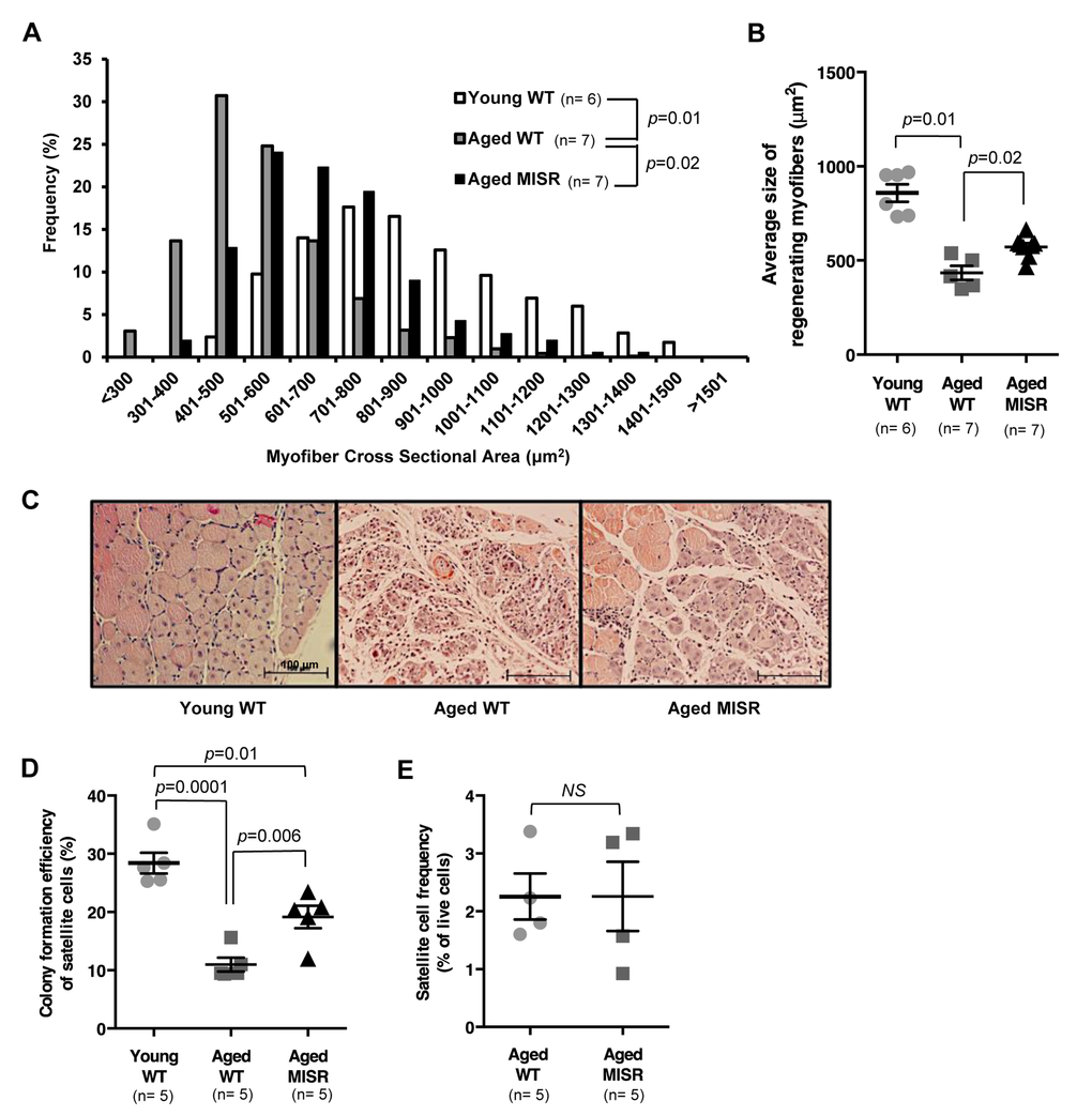 Muscle fiber-specific transgenic inhibition of NF-κB activity improves satellite cell function in an aging model. (A, B) Distribution and average of cross-sectional area of regenerating (centrally nucleated) fibers in injured TA muscle of young (n=6 mice) or aged WT (n=7 mice), or aged MISR mice (n=7 mice) at 7 days after cryoinjury. Data represented as histograms of fiber size (A) or as mean ± s.e.m. (B). P-values calculated by Kruskal-Wallis test with Step-down Bonferroni method. (C) Representative H&E staining of muscle sections taken 7 days after cryoinjury in young WT, aged WT or aged MISR mice. Scale bars, 100 μm. (D) Myogenic colony forming efficiency of satellite cells from young (n=5 mice) or aged (n=5 mice) WT or aged MISR (n=5 mice) mice. Data presented as mean ± s.e.m. P-values calculated by one-way ANOVA. (E) Frequency of satellite cells (percent of live cells by flow cytometry) in uninjured muscle of aged MISR (n=5 mice) or aged WT mice (n=5 mice). MISR mice were allowed to age alongside age-matched wild-type controls for these studies. Data presented as mean ± s.e.m. P-values calculated by Student’s t test. For all studies, young mice were 2-3 months old, and aged mice were 24 months old.