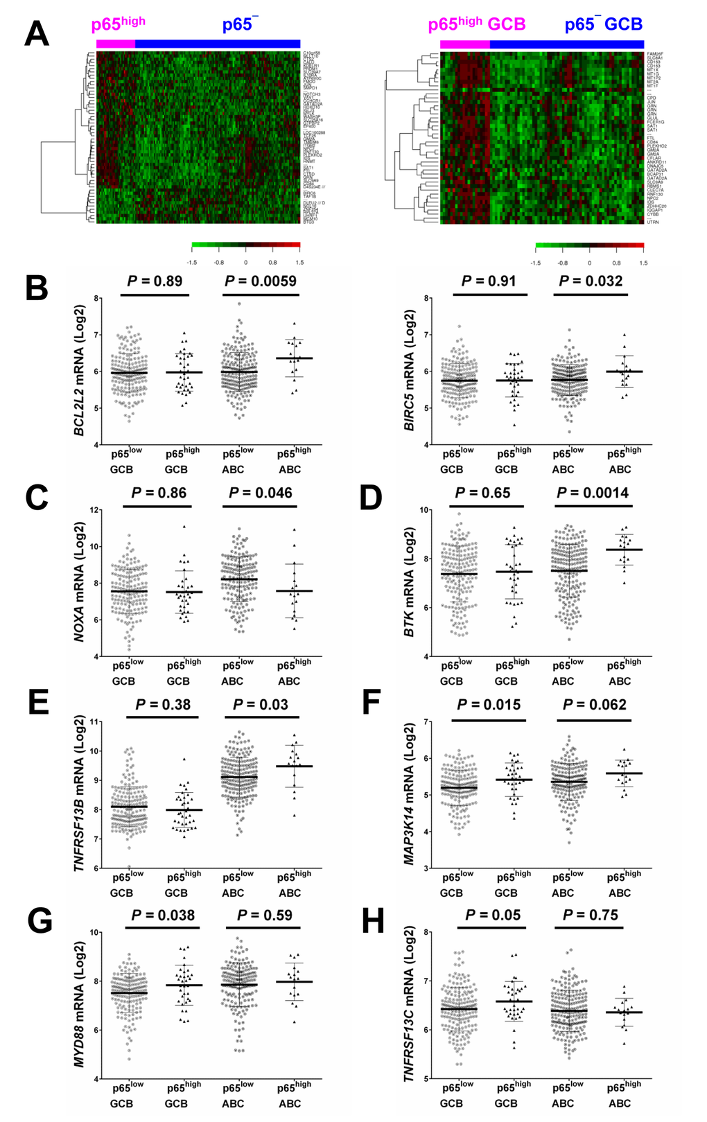 Gene expression profiling analysis. (A) Heatmaps for comparisons between DLBCL patients with p65high expression (IHC ≥50%) and those without p65 nuclear expression (IHC B) BIRC5/survivin and BCL2L2 were significantly upregulated in p65high ABC-DLBCL. (C) NOXA/PMAIP1 was significantly downregulated in p65high ABC-DLBCL. (D-E) BTK and TNFRSF13B were significantly upregulated in the p65high group in ABC-DLBCL but not in GCB-DLBCL. (F-H) MAP3K14/NIK, MYD88, and TNFRSF13C were significantly upregulated in the p65high group in GCB-DLBCL but not in ABC-DLBCL.