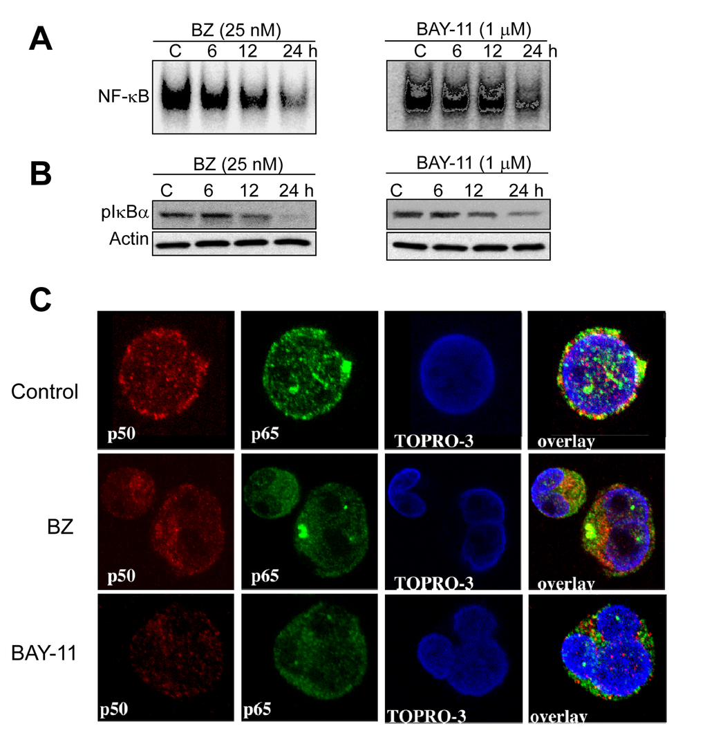 Pharmacological inhibition of constitutive NF-κB activation in DLBCL cells. (A-B) DLBCL cells (MS) were cultured in the presence of bortezomib (BZ, 25 nM) or BAY-11 (1 µM) for the indicated time points (hours). Nuclear extracts were purified and subjected to EMSA analyzed for NF-κB DNA binding activity; cytoplasmic extracts were subjected to immunobloting for pIκBa and actin. (C) DLBCL-MS cells cultured in the presence of bortezomib (BZ, 25 nM) or BAY-11 (1 µM) for 24 hours and then analyzed for p50 (red) and p65 (green) protein expression by confocal microscopy analysis. Topro-3 (blue) serves as a nuclear staining marker.