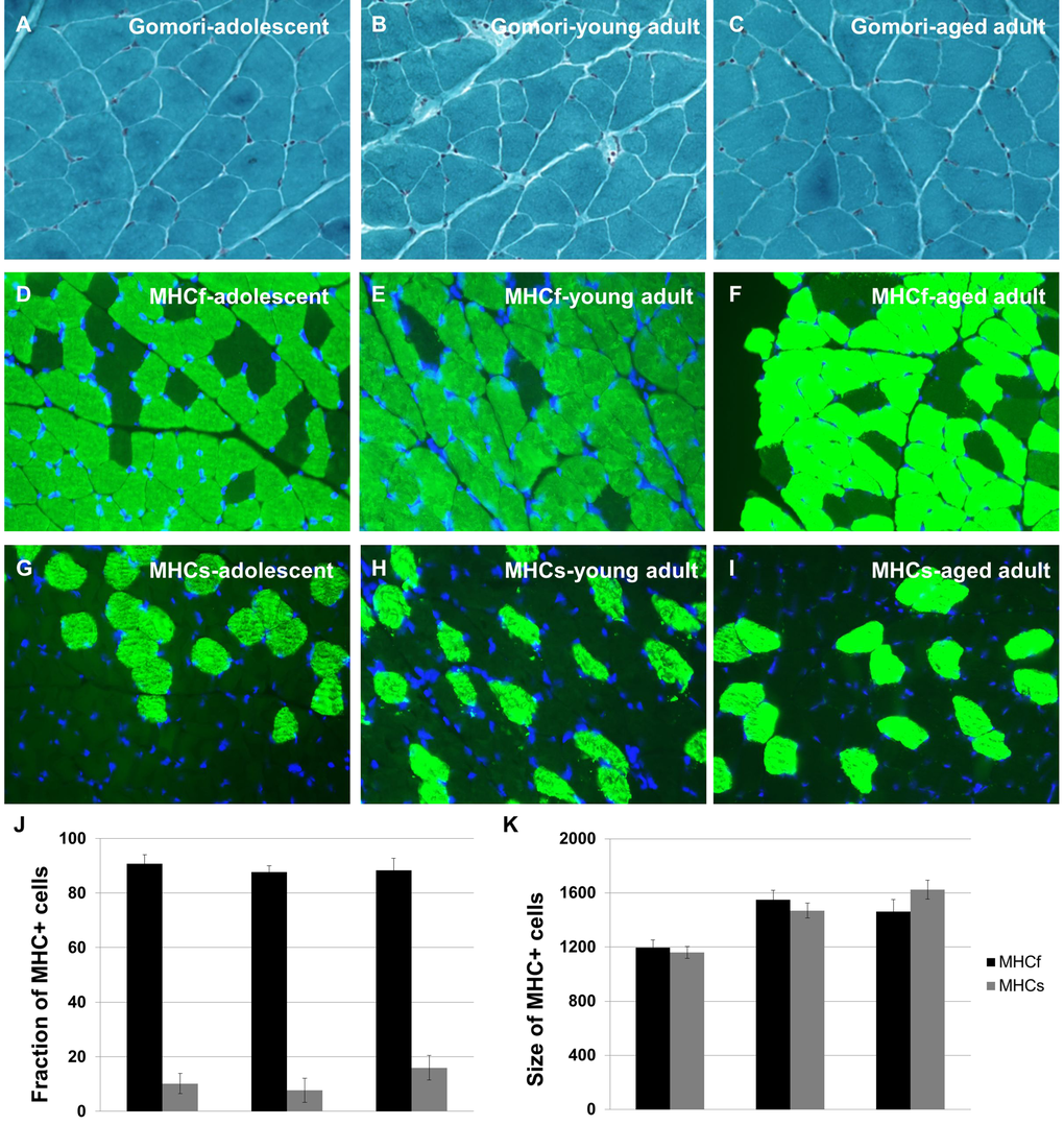 Naked mole-rats do not undergo changes in skeletal muscle integrity during aging. Quadriceps muscle tissue sections were subjected to Gomori Trichrome Staining to reveal ragged red fibers; no such fibers were observed at any age (A-C). Quadriceps muscle tissue sections were immunohistochemically labelled with myosin heavy chain-specific antibodies to assess the relative numbers of fast-twitch and slow-twitch fiber types across the lifespan (D-I). No change in number was observed for either fiber type with age (J-K). Approximately 10% of muscle fibers in the naked mole-rat are MHCs+ at all ages studied, similar to the rat.