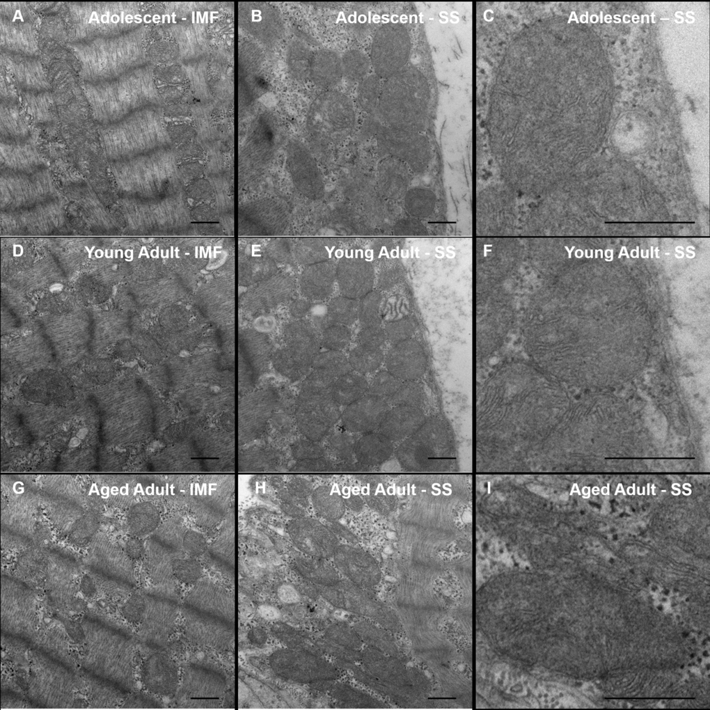 Transmission Electron Microscopy (TEM) of naked mole-rat skeletal muscle. Naked mole-rat skeletal muscle tissue was fixed in glutaraldehyde and sectioned in preparation for TEM. Samples from each age group (adolescent, A-B; young adult, C-D; aged adult, E-F) were viewed in a blinded fashion. No obvious differences in ultrastructure are observed between samples. Specifically, no signs of age-related pathology such as autophagy or abnormal mitochondrial morphology are observed in any sample. Both intramyofibrillar (IMF) and subsarcolemmal (SS) regions are shown. Scale bars signify 500 nm.