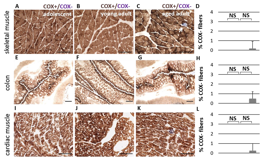 No significant difference in Complex IV activity is observed during aging. Cytochrome c Oxidase activity (COX, in brown) is observed consistently in adolescent (A), young adult (B), and aged adult (C) NMR skeletal muscle tissue (quadriceps). A small number of COX-deficient cells (in blue) are observed in aged adults; this number does not significantly increase with age (D, p > 0.05, two-tailed t-test). Similar patterns were observed in colon tissue (E-H) and cardiac muscle (I-L).