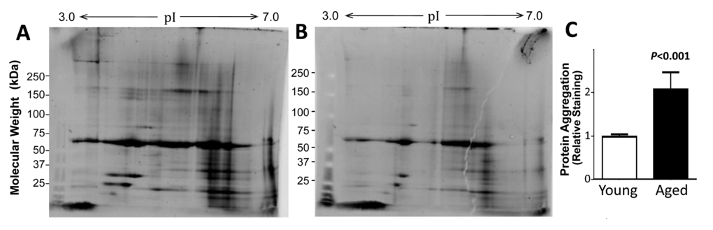 The protein content of muscle aggregates from older subjects was higher than that from young adults. Sarcosyl-insoluble aggregates were isolated from muscle of old (A) and young (B) donors (pooled, N=2 per group), dissolved in ampholyte buffer, resolved on 2D gels, and stained for total protein. Aggregates from 5 individuals per group were resuspended and heated to 95oC in Laemmli buffer (containing 2% SDS, w/v, and 0.5% ß-mercaptoethanol, v/v), and resolved on 1D gels to quantify total aggregate protein (C). Mean ±SD is shown after normalization to mean total aggregate protein for the young group.