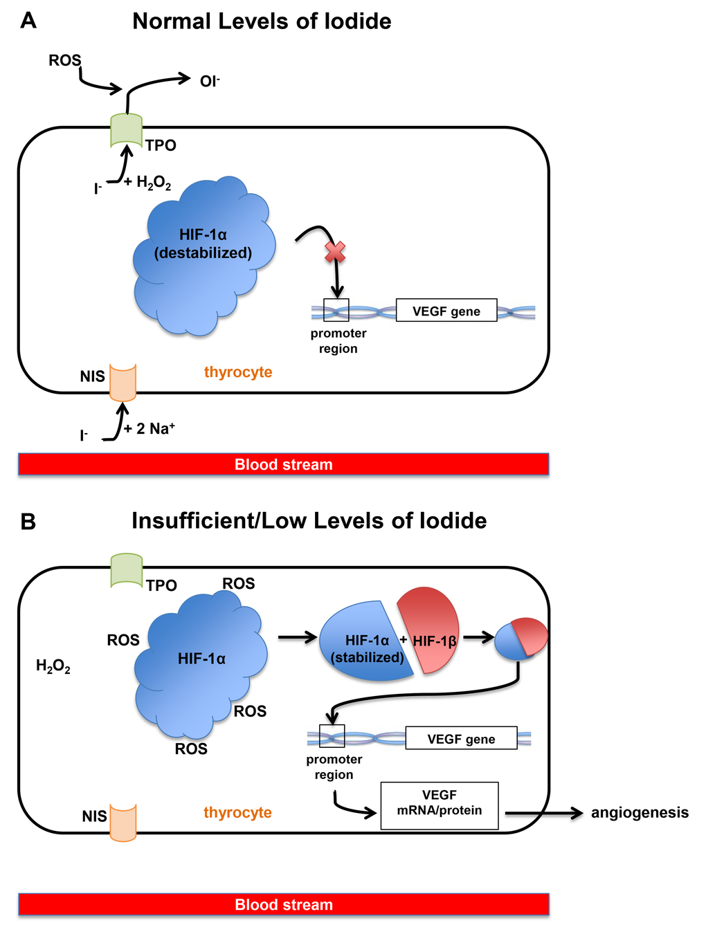 (A) When iodide exists at normal or sufficient levels in the blood, one iodide ion enters a thyrocyte along with sodium via NIS (sodium-iodide symporter) at the basolateral membrane of the cell. The iodide moves to the apical membrane of thyrocytes along with molecules of hydrogen peroxide. Finally, iodide is oxidized and HIF-1α (hypoxia inducible factor-1α) remains unstable and therefore unable to bind to the VEGF (Vascular Endothelial Growth Factor) promoter. Ultimately, this mechanism reduces the VEGF expression. (B) When iodide exists at insufficient levels in the blood, thyrocytes and thyroid follicles also contain low levels of iodide or no iodide, and cytoplasmic ROS (reactive oxygen species) levels remain high because there is no iodide to be oxidized. These ROS stabilizes HIF-1α, allowing the binding of HIF-1α with HIF-1β, which binds to the VEGF promoter and allows transcription of the VEGF gene.