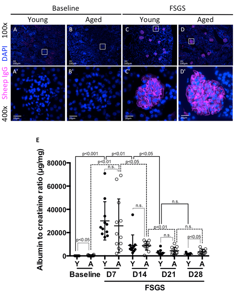 Albuminuria was higher in aged mice at baseline and in FSGS. (A-D) Sheep IgG staining. Sheep IgG staining confirmed the equal distribution of anti-glomerular antibody in the glomerular tuft in both young (Y) and aged (A) mice. Images were taken at 100x. (A'-D') 400x close-up images of glomeruli from (A-D). Sheep IgG deposition (purple color) was not seen in baseline mice as expected (A,B,A',B'). Animals given FSGS with the anti-glomerular antibody showed sheep IgG deposition in the glomerular tufts (C, D, C’, D'). (E) Albumin to creatinine ratios (ACR). ACRs (µg/mg) for young mice (black circles), and aged mice (white circles), at baseline prior to FSGS and at days 7, 14, 21 and 28 post-FSGS. ACR increased acutely for both young and aged animals to peak at D7, followed by gradual recovery for 21 days. Aged mice started with higher ACR at baseline and finished with significantly higher ACR at D28.