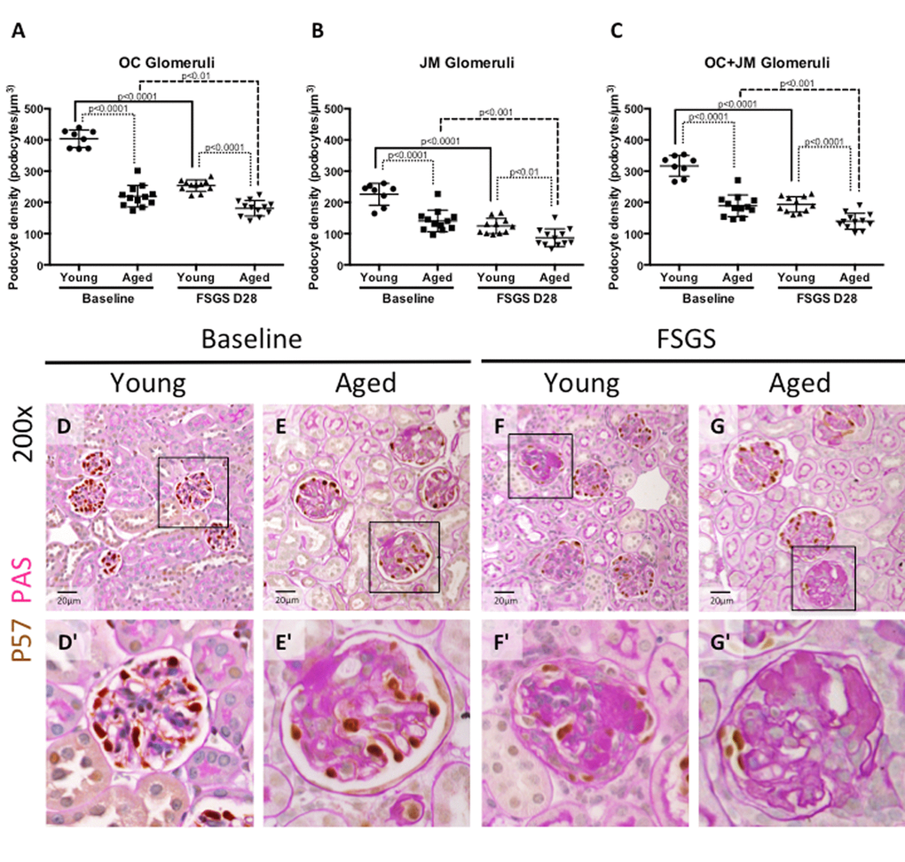 Podocyte density was lower at baseline in aged mice, and in aged mice with FSGS. (A-C) Quantification of podocyte density. Graphs A and B show the average podocyte density in podocytes per glomerular volume (µm3) for individual animals in OC and JM glomeruli respectively. Graph C shows podocyte density for individual animals when OC and JM glomeruli are combined, which serves as a representation of the entire section. Podocyte density was lower in aged baseline mice than young baseline mice in glomeruli of the OC (A), JM (B), and when combined (C). Aged FSGS mice also had lower podocyte density in OC (A), JM (B), and combined (C) glomeruli than young FSGS mice, despite young mice experiencing a larger magnitude of podocyte depletion with FSGS. (D-G) PAS/p57 double staining. Representative images of glomeruli at 20x magnification, with higher magnifications shown in D’-G’ of the glomerulus marked by solid black square. Podocytes were identified by p57+ staining (brown color, nuclear) against the pink PAS counterstain.