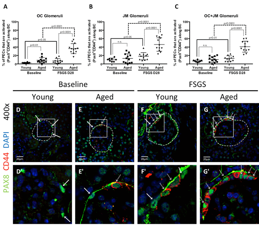 Parietal epithelial cell (PEC) activation was highest in aged FSGS mice. PECs were identified by PAX8 staining (green color, nuclear), and the subset of PECs undergoing activation were identified by CD44 staining (red color, cytoplasmic). (A-C) Quantitation of the percentage of PECs that are activated. (A) In outer cortical (OC) glomeruli, the percentage of PECs that were activated (PAX8+CD44+) along Bowman’s capsule (BC) was higher in aged mice at baseline and in FSGS. (B) In juxta-medullary (JM) glomeruli, the percentage of activated PECs were similar at baseline, but higher in aged FSGS mice compared to young FSGS mice. (C) When OC and JM glomeruli were combined, aged FSGS mice had the highest percentage of PECs that were activated. (D-G) Representative images of Pax8 and CD44 staining on BC. Images taken at 400x by confocal microscopy for PAX8 (green, nuclear), CD44 (red, cytoplasmic) and DAPI (blue, nuclear) staining. (D’-G’) Higher magnification of the white square shown above. Solid arrow shows examples of PAX8 staining; dashed arrow shows examples of CD44 below (D’-G’). As shown in the above graphs, the percentage of PECs along Bowman’s capsule that are activated was higher in aged baseline mice, and increased further at D28 of FSGS in aged mice.