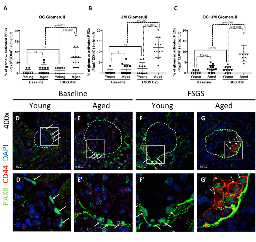 Activated PECs migrated from Bowman’s capsule to the glomerular tuft in FSGS. (A-C) Quantitation showing the percentage of glomeruli with activated PECs (PAX8+CD44+) on the glomerular tuft. Aged FSGS mice had the highest percentage of activated PECs on the tufts of outer cortical (OC) (A), juxta-medullary (B) and combined OC and JM (C) glomeruli. (D-G) Representative images of Pax8 and CD44 staining on tuft. Images of glomeruli (400x) taken by confocal microscopy, showing staining for PAX8 (PEC marker, green, solid arrows), CD44 (activation marker, red, dashed arrows) and DAPI (nuclei, blue). Glomeruli are marked by the dashed line. (D’-G’) Higher power images of the area demarcated by the solid square shown above. PAX8 staining was detected along Bowman’s capsule in young baseline (D, D’) and aged baseline (E, E’) mice, but not in the glomerular tuft. (F, F’) In young FSGS mice, activated PECs were not readily detected on glomerular tufts. (G, G’) Activated PECs were detected on the glomerular tuft of aged FSGS mice. These results show that activated PECs were detected on the tuft of a subset of aged FSGS glomeruli.