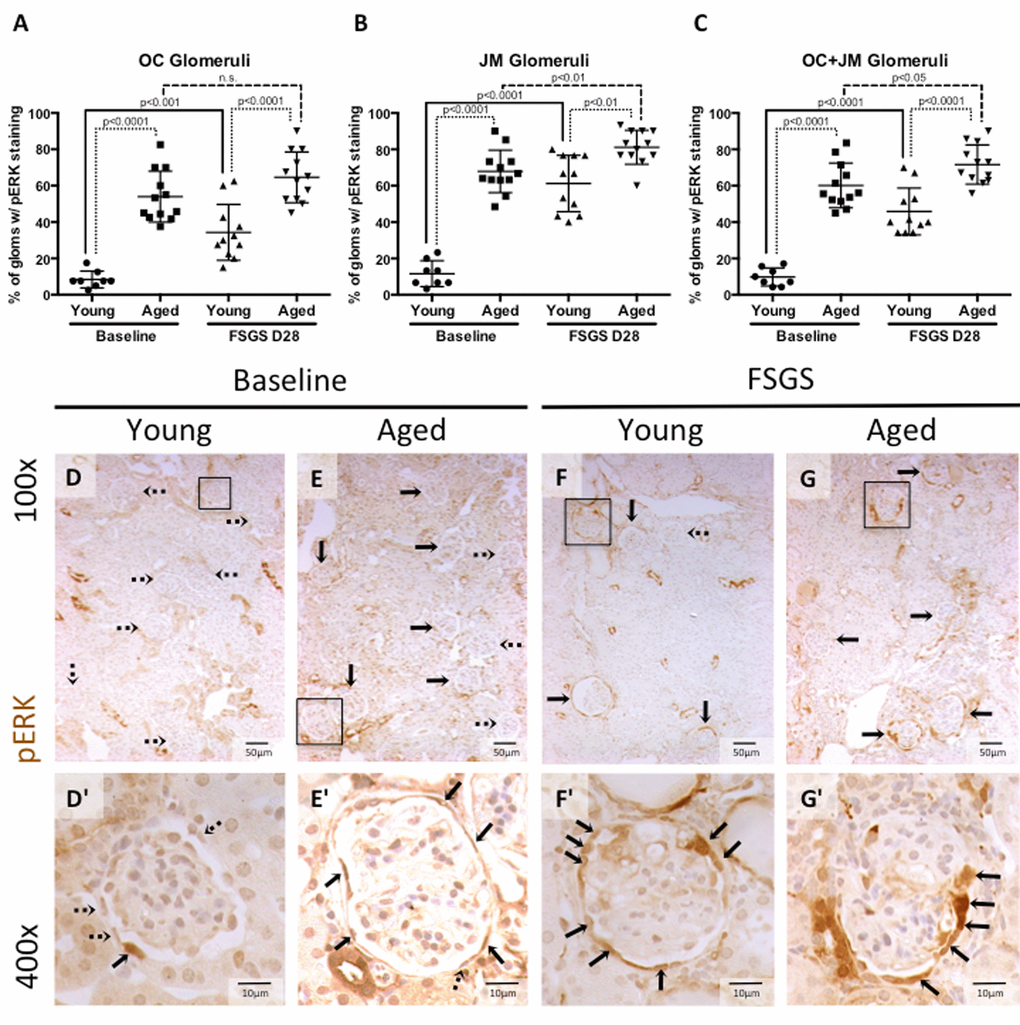 Percentage of glomeruli with phosphorylated-ERK stained PECs was highest in aged baseline mice with FSGS. (A-C) Quantitation showing the percentage of glomeruli with pERK staining of PECs along Bowman’s capsule. Aged mice and aged mice with FSGS had a higher percentages of glomeruli with pERK staining along Bowman’s capsule when compared to their respective young baseline and young FSGS mice in outer cortical glomeruli (OC) (A), juxta-medullary glomeruli (B) and combined OC and JM glomeruli(C). Overall, aged FSGS mice had the highest percentage of glomerular with pERK staining (C). (D-G) Representative images of pERK staining along Bowman’s capsule. Representative images of glomeruli at 100x magnification, with 400x magnifications shown in D’-G’ of the glomeruli marked by solid black square. Dashed arrows indicate pERK negative and solid arrows indicated pERK positive glomeruli (100x) and PECs (400x).