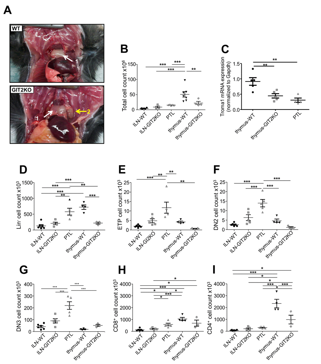 Development of idiosyncratic parathymic lobes in GIT2KO mice. Large parathymic lobes (PTLs) were consistently observed in 12 month old GIT2KO mice only (A: 1-thymus, 2-PTL). Total cell count data measured in WT and GIT2KO inguinal and mesenteric lymph nodes (ILN and MLN respectively), thymus and PTLs (GIT2KO only) (B). (C) PTLs express significantly lower Troma-I expression compared to WT or GIT2KO thymus (C). PTLs also demonstrate significantly-distinct patterns (compared to WT and GIT2KO thymus, ILN and MLN) of total counts for Lin- (D), ETP (E), DN2 (F) and DN3 (G) T cell precursors, as well as for CD8+ (H) and CD4+ (I) cells. All values indicated are mean ± SEM. For histograms WT data are represented by solid black objects, with GIT2KO data represented by lined objects. Months of age is abbreviated to m.o. *p