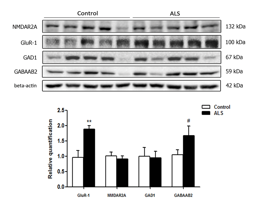 Gel electrophoresis and western blotting to glutamate receptor ionotropic, NMDA 2A (NMDAR2A), α-amino-3-hydroxy-5-methyl-4-isoxazolepropionic acid receptor 1 (GluR-1), glutamate decarboxylase 1 (GAD1) and gamma-aminobutyric acid receptor subunit beta-2 (GABAAB2) in the frontal cortex area 8 of control and ALS. Significant increased levels of GluR-1 and a tendency to increased levels of GABAAB2 are seen in ALS when compared with controls. The significance level is set at ** p 