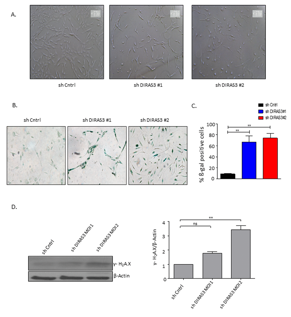 Silencing of DIRAS3 induces premature senescence in human ASCs. (A) Morphology of ASCs infected with shCntrl and shDIRAS3 was documented using light microscope at 40x magnification. (B and C) ASCs infected with either shDIRAS3 or shControl (shCntrl) expressing lentiviruses were fixed and stained for SA-β-GAL. Percentage of SA-β-GAL positive cells was calculated by scanning 5 low-power magnification fields (n=3). (D) ASCs were transduced by indicated lentiviruses with increasing MOI and cell lysates immunoblotted using phospho-Ser-139 Gamma H2A.X antibody. β-Actin served as a loading control.