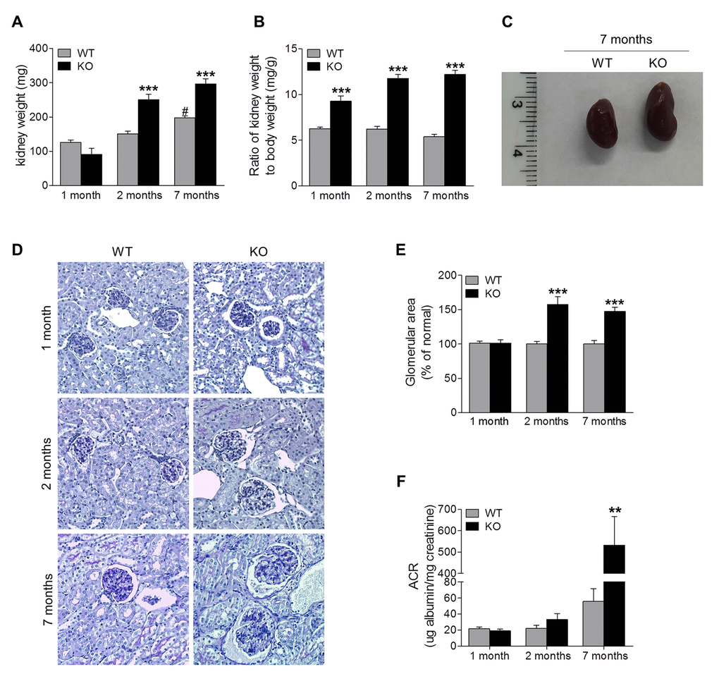 Sirt6 deficiency causes kidney hypertrophy and proteinuria. (A, B) Kidneys from WT and Sirt6 KO mice were collected at 1, 2, 7 months of age. The weight of kidney was quantified (A) and the ratio of kidney weight to body weight was calculated (B). (C) Representative image of the kidneys from WT and Sirt6 KO mice at 7 months of age. (D) Periodic acid–Schiff staining of kidney paraffin section for histologic analysis. (E) Quantification of glomerular area (~15 glomeruli/section). (F) Urine was collected from WT and Sirt6 KO mice at indicated time points. Albumin and creatinine were measured by Albumin ELISA kit and Creatinine Colorimetric Assay Kit respectively, and ACR was calculated. Data are presented as mean ± SEM; n=6-9; **P#P