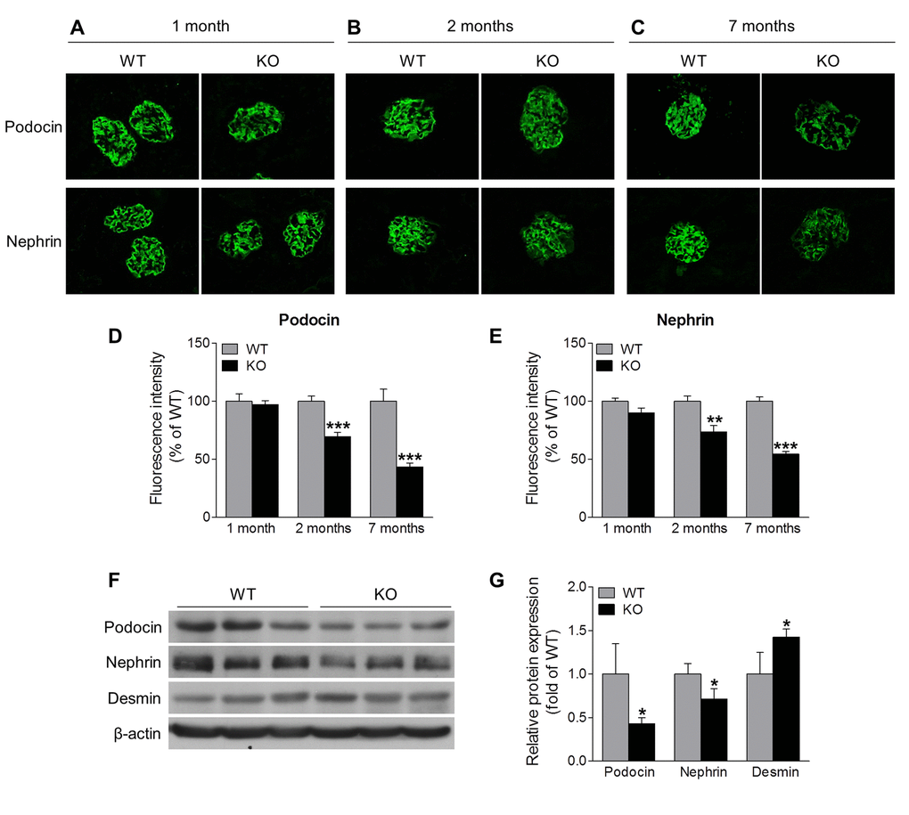 Sirt6 deletion induces podocyte injury. (A-C) Immunostaining of podocin and nephrin (green) in the kidney cryosection from WT and Sirt6 KO mice at different ages. (D, E) Graphs represent the quantification of podocin and nephrin immunofluorescence. Data are presented as mean ± SEM. **PF) The cortex of kidney from WT and Sirt6 KO mice was collected at 7 months of age and lysed, and podocyte slit diaphragm proteins (podocin and nephrin) and podocyte injury marker desmin were examined by Western blot analysis. (G) Graph represents the densitometry of podocin, nephrin and desmin expression normalized to β-actin. Data are presented as mean ± SEM; n=3; *p