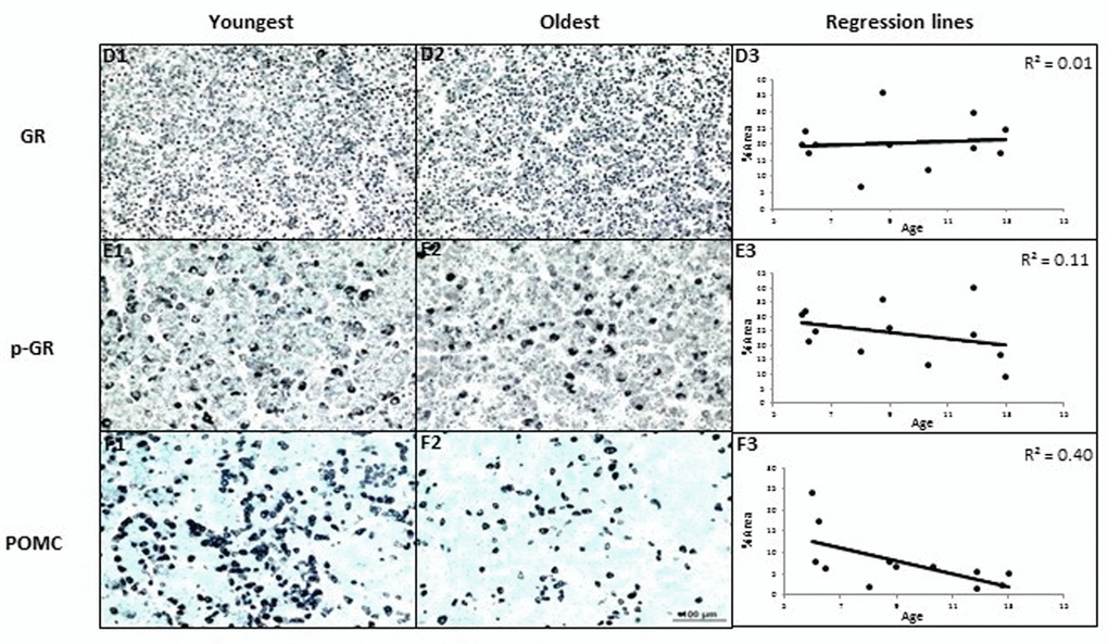 The effects of age on area% positive staining of proteins in pituitary of female baboons (P. hamadryas). POMC expression showed negative age-related linear regression in anterior pituitary (n = 12, R = -0.63, P 