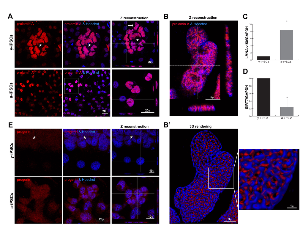 Distribution of prelamin isoforms and expression of LMNAΔ150 and SIRT7 in iPSCs, in pluripotent state and following differentiation and senescence. (A) Prelamin A was throughly distributed inside iPSCs nuclei of the colony cells (asterisk) and aged cells, as represented by XYZ stacks (right column), and it colocalized with nucleic acid stain (Hoechst, blue), as visualized in high magnifications (of the inset for a-iPSCs, and of y-iPSCs nuclei (arrow) showed in (B). (B) XYZ high magnification of y-iPSCs nuclei (indicated in a, arrow) showing a clear intranuclear accumulation of prelamin A in pluripotent stem cells. (B’) Deconvolved 3D-rendering of raw Z stack (in B) showing tight interconnections between prelamin A and chromatin distribution (high magnification of the inset, right). (C) Relative expression levels of LMNAΔ150 mRNA expression in y-iPSCs (*: p D) Relative expression levels of SIRT7 mRNA in y-iPSCs and a-iPSCs (*: p E) Progerin expression was undetectable in y-iPSCs of the colony (asterisk) and in differentiated cells, whereas it appeared in senescent iPSCs.