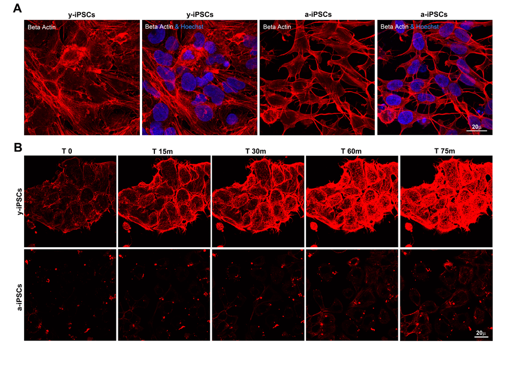 Slow actin polymerization rate is associated to senescence in a-iPSCs. (A) Basal expression of beta actin in iPSCs, showing defects in cytoskeletal organization of F-actin in aged cells. (B) Representative images of time-lapse experiments performed on y-iPSCs and a-iPSCs, after cytochalasin D treatment and loading with SiR-actin probe, to monitor the actin cytoskeleton functionality.