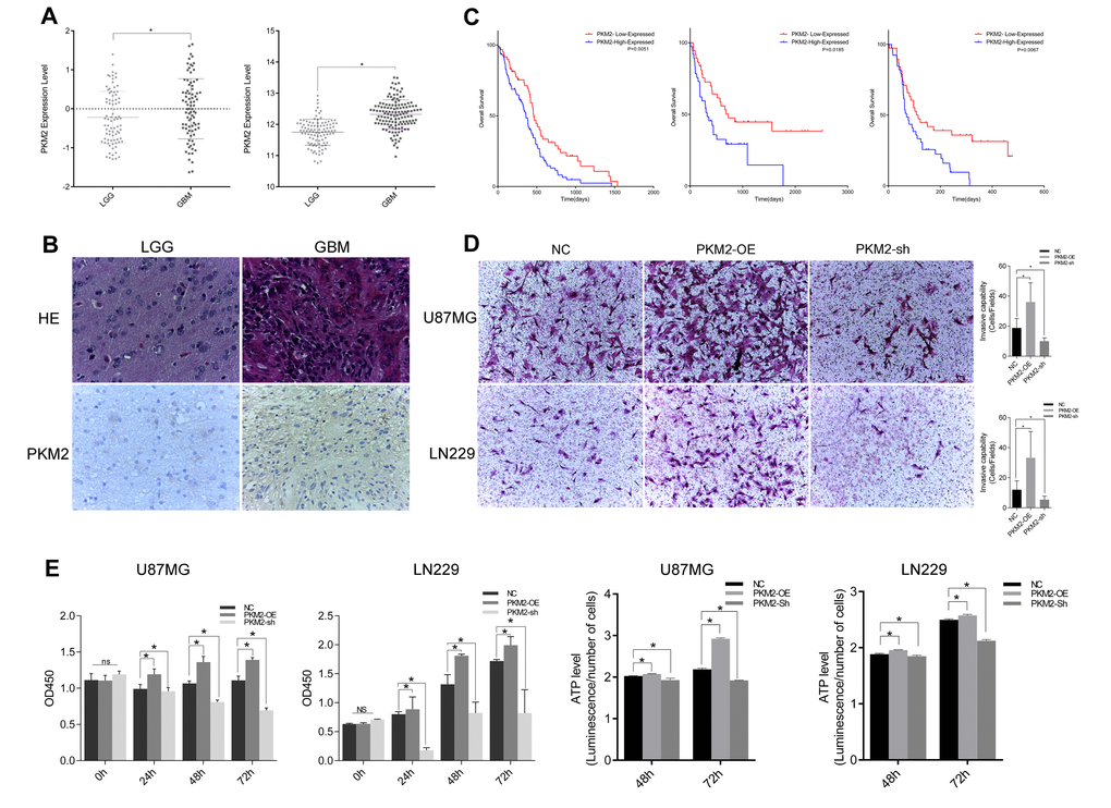 PKM2 correlated with glioma grade progression and promoted glioma cell proliferation and invasion. (A) PKM2 expression and its correlation with glioma grade prognosis in the CGGA and REMBRANDT. (B) IHC staining depicting the difference in PKM2 expression between low-grade and high-grade gliomas. (C) Kaplan-Meier survival curves indicating cumulative survival as a function of time for patients with high versus low PKM2 expression. (D) Representative images of Transwell assays of cells after transfection. Number of invading cells shown as a histogram (PE) Cell viability was examined with a CCK-8 assay at different time intervals after transfection. (F) ATP level assay at different time intervals after transfection (P