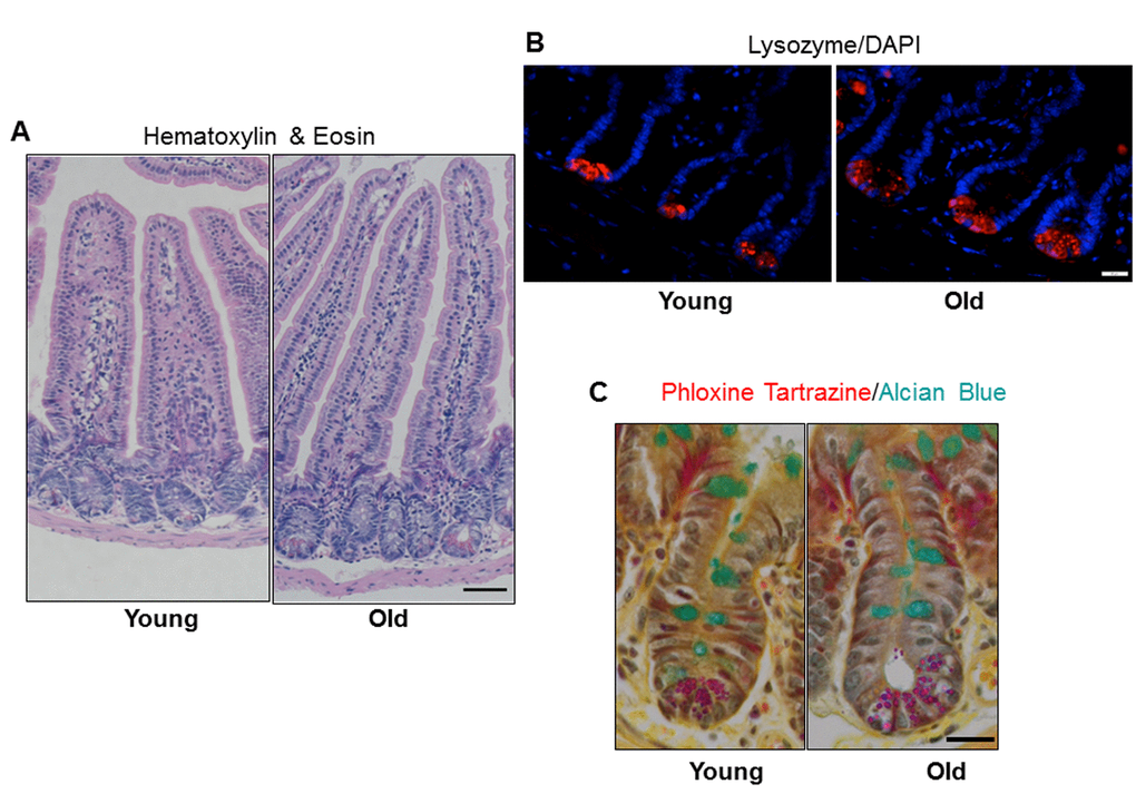Increased jejunal villus height and number of Paneth cells per crypt with age. (A) Representative hematoxylin and eosin stained sections of jejunal cross-sections from young and old mice showing crypt and villus architecture. Images were taken at 10x magnification. Scale bar, 50µm. (B) Representative images of crypt sections stained for the Paneth cell marker Lysozyme and nuclear marker DAPI. Magnification: 40x, Scale bar: 20µm. n=6 animals per group. (C) Representative images of crypt sections stained for the Phloxine Tartrazine and the Goblet cell marker Alcian Blue. Magnification: 40x, Scale bar: 20µm. n=5 young and 6 old animals.