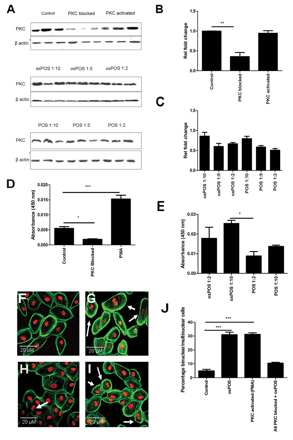 Role of PKC in RPE cell multinucleation and oxPOS induced PKC activation in RPE cells. (A) Representative Western blots showing total PKC protein expression in RPE cells following PMA, total PKC blockade, no treatment and with different concentrations of POS or oxPOS treatments (RPE: POS/oxPOS 1:2, 1:5, 1:10) for 48h. (B-C) quantification of total PKC expression in different treatment groups. The data are represented as relative fold change to the control. (D) Active PKC levels in RPE cells following PMA, total PKC blockade treatments, or untreated control for 48h. (E) Active PKC protein levels in RPE cells following POS or oxPOS treatment at 1:10 and 1:2 (RPE: POS/oxPOS) for 48h. Cells from each treatment group was homogenised and protein levels were evaluated by active PKC ELISA kit. *, P F-I): histochemical staining of propidium iodide (PI) and Phalloidin in control untreated ARPE19 (F), PMA treated ARPE19 (G), PKC blocked ARPE19 (H) and oxPOS (I) treated ARPE19 cells. Arrows indicate multinucleate RPE cells. (J) histogram showing the percentage of binucleated and multinucleate RPE cells, ***, P 