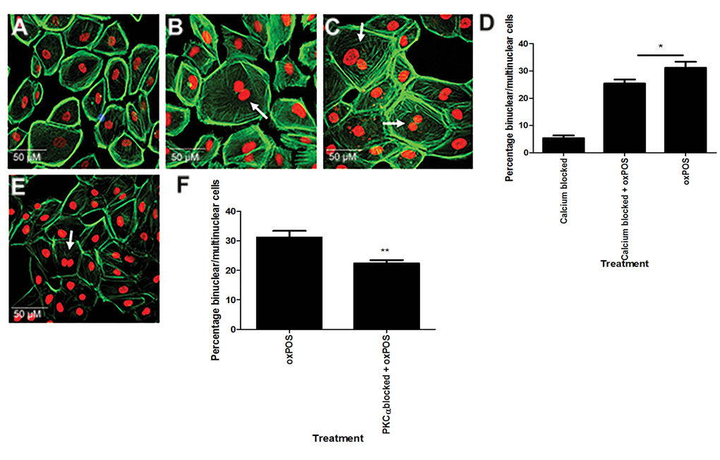 Involvement of Ca2+ signalling in RPE cell multinucleation. Intracellular calcium was blocked in ARPE-19 cells using BAPTA-AM. (A) calcium blocked cells. (B) calcium blocked + oxPOS treated cells. (C) oxPOS treated cells. Arrows indicate multinucleate RPE cells. (D) histogram showing the percentage of binucleate and multinucleate RPE cells following calcium chelation *, P E) PKCα inhibitor-treated RPE cells. (F) histogram showing the percentage of binucleate and multinucleate RPE cells after PKCα blockade **, P 