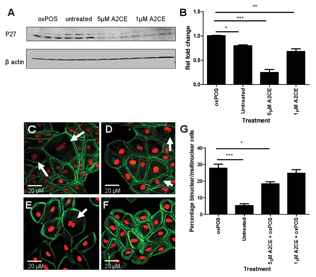 Inhibition of p27kip1 using Alsterpaullone, 2-Cyanoethyl (A2CE) and its effect on RPE multinucleation. (A) representative western blot from oxPOS, control, 5μM A2CE and 1μM A2CE treated RPE cells showing p27kip1 at 28 KDa and β-actin at 40 KDa. (B) quantification of p27kip1 protein expression by RPE cells in the different treatment groups. Signals for POS treated group were set to one and the data are represented as relative fold change to the POS group. * P C); POS-treated, (D); 1μM A2CE, (E); untreated RPE cells, (F); 5μM A2CE). (G) histogram showing the percentage of binucleate/multinucleate RPE cells following different treatments, * P 