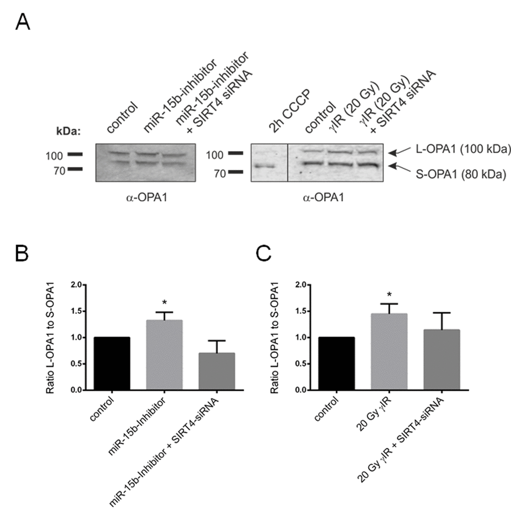 Aging-associated SIRT4 upregulation leads to a shifted L-OPA1 to S-OPA1 ratio in two different fibroblast senescence models. Primary human dermal fibroblasts were either transfected with miR-15b inhibitors (or control oligonucleotides) or subjected to γ−irradiation (γIR; 20 Gy) (both in the presence or absence of siRNA duplexes against SIRT4) [35] followed by analysis of OPA1-L and OPA1-S expression by immunoblotting after four days (A) As a control for complete proteolytic processing of L-OPA1 to S-OPA1, fibroblasts were treated with CCCP (10 µM) for two hours. The ratio between the expression levels of L-OPA1 and S-OPA1 was determined by ImageJ-based densitometric analysis in miR-15b inhibitor transfected fibroblasts (B) and cells subjected to γIR (C). To evaluate statistical significance (compared to control), two-way ANOVA followed by Tukey’s test was performed (*p