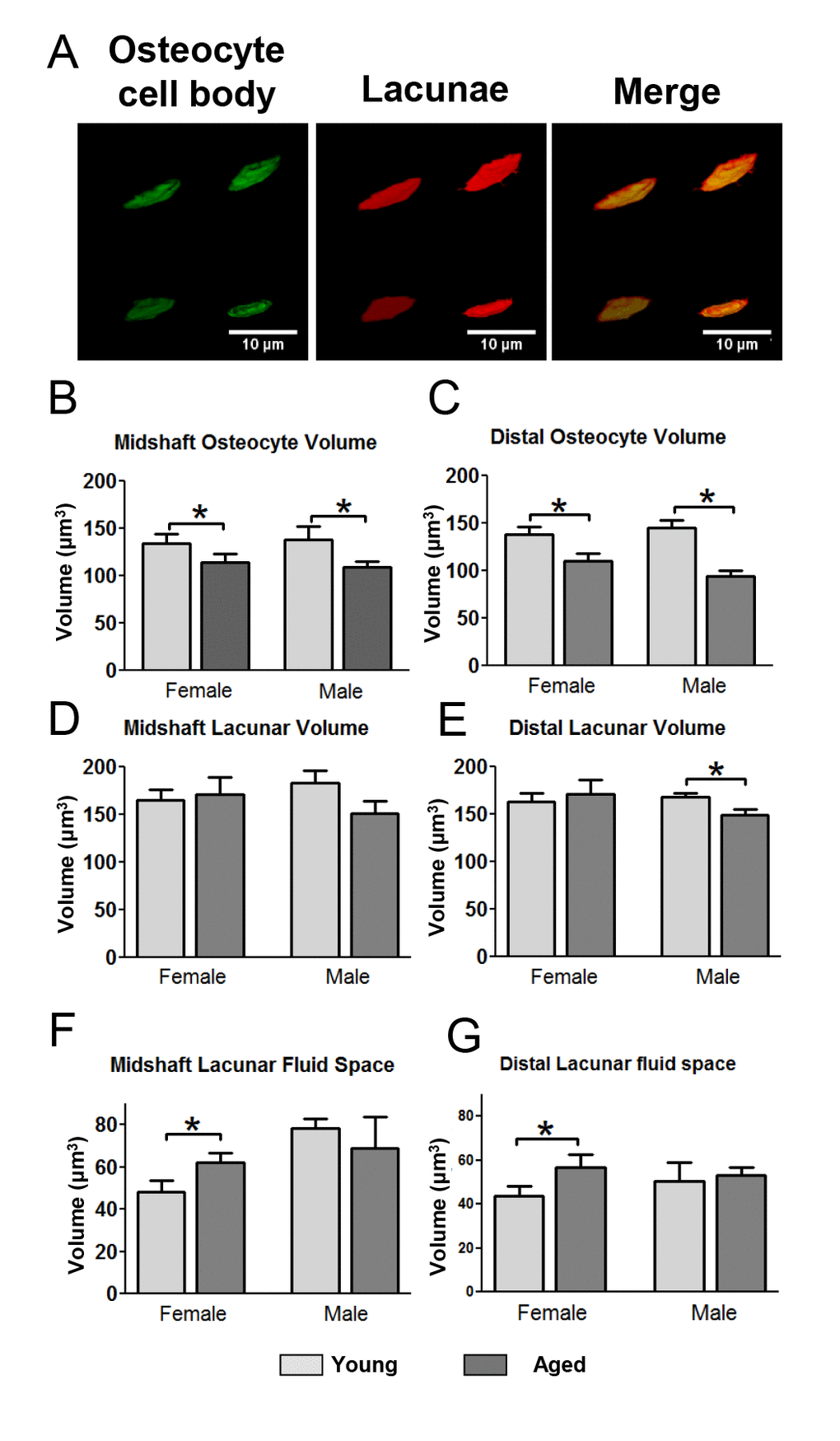 Decreased osteocyte cell volume with decreased lacunar volume in aged males but not females leads to gender differences in lacunar fluid volumes. (A) Examples of 3D renderings of the osteocyte cell bodies labeled with DiO and lacunae labeled with fixable Tx-Red-dextran for volumetric calculations. (B and C) quantitation of osteocyte cell body volume in the midshaft (B) and distal (C) region. (D and E) quantitation of the corresponding lacunar volumes. (F and G) show calculation of the lacunar fluid space derived from subtracting the osteocyte cell body volume from its corresponding lacunar volume. (Data are mean ± SEM, * = p 0.05, ANOVA/Tukey’s; n= 5).