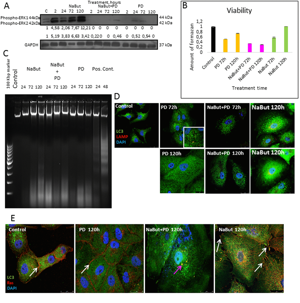 Senescent human Ki-Ras-mutated lung adenocarcinoma A549 cells after MEK/ERK suppression undergo autophagy impairment, Ras relocalization and cell death. (A) Western-blot analysis of ERK1,2 phosphorylation after short-term (2 h) and long-term (24 h-120 h) NaBut, NaBut + PD and PD treatment. Cells were exposed to inhibitors for the indicated time and then lysed and processed to Western-blotting in 12% gel. Numbers below present densitometry of bands. (B) Cell viability analyzed by MTT-test. In the indicated time intervals cells were processed with MTT reagent, the amount of formazan was measured at 570 nm wavelength. Data are presented as mean ±S.E.M. of three independent experiments (n=3). (C) Electrophoresis in 2% agarose gel of DNA extracted from untreated cells and cells after exposure to inhibitors shows the absence of nucleosomal DNA fragmentation in treated cells. DNA visualized with ethidium bromide. DNA extracted from serum-starved ERas cells undergoing apoptosis was used as a positive control. (D) Immunofluorescence images demonstrating LC3 and LAMP1 levels and colocalization after 72 h and 120 h of treatment. Cells were treated with inhibitors or left untreated and stained with antibodies against pan-LC3 (green) and LAMP1 (red). Nuclei stained with DAPI (blue). Scale bars: 25 µm. (E) Immunofluorescent images showing Ras (red) and LC3 (green) localization after 120 h of treatment. Cells were exposed to inhibitors for indicated time, then fixed and stained with antibodies against pan-Ras and pan-LC3. White arrows show membrane-bound Ras; pink arrow shows Ras in cytoplasm of senescent cells with inhibited MEK/ERK. Nuclei stained with DAPI (blue). Scale bars: 25 µm.