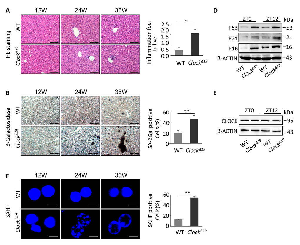 Accelerating the liver aging phenotypes of mice with Clock∆19. (A) Histological analysis of WT and ClockΔ19 mice (12, 24 and 36 week old). HE staining of inflammation foci in liver. Data were analyzed by Student’s t-test and displayed as the mean ± S.E.M. Asterisks indicate values significantly different from WT (n=4 for all groups). **, PPB) Liver tissues stained for SA-β-gal activity. The results are expressed as the mean ± S.E.M. A significant increase in the number of positive areas was observed with ClockΔ19 (n=4 for all groups). **, PPC) Hepatocytes were stained for SAHF foci in WT and ClockΔ19 mice. Note that the livers of ClockΔ19 mice show a clear aging phenotype. The results of the SAHF analysis are representative images of four experiments. **, P; *, P (D) Immunoblots of liver tissue from WT and Clock∆19 mice at ZT0 and ZT12 for P53, P21 and P16 indicate the accelerated aging phenotypes. β-ACTIN was used as the loading control. **, P  and *, P  versus control. n=4 mice per group. (E) Immunoblots of ClockΔ19 in mouse liver tissue at ZT0 and ZT12. Note that there was no change in the protein levels in Clock∆19 mice (n=4). **, P; *, P.