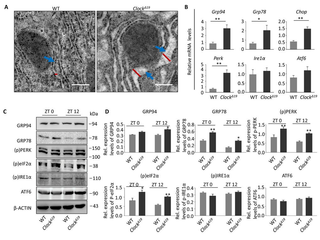 Clock∆19 results in ER stress in mice. (A) TEM depicting the luminal diameter of the ER in WT and Clock∆19 hepatocytes. Clock∆19 mouse hepatocytes show the expansion of the ER (blue arrow; n=4 for all groups). (B) Relative expression assessed by qPCR of the UPR pathway genes in the liver of WT and ClockΔ19 mice from 16 weeks of age. Note that the expression of Grp94, Grp78, Chop and Perk were significantly increased in Clock∆19 mice. Data were normalized to Gapdh expression (n=4). **, P  0.01 and *, P  0.05. (C-D) Immunoblots of liver tissue from WT and Clock∆19 mice at ZT0 and ZT12; the UPR proteins GRP94, GRP78, (p)PERK and (p)eIF2α are significantly activated in Clock∆19 mice. β-ACTIN is a loading control. **, P  0.01 and *, P  0.05 versus control. n=4 mice per group.