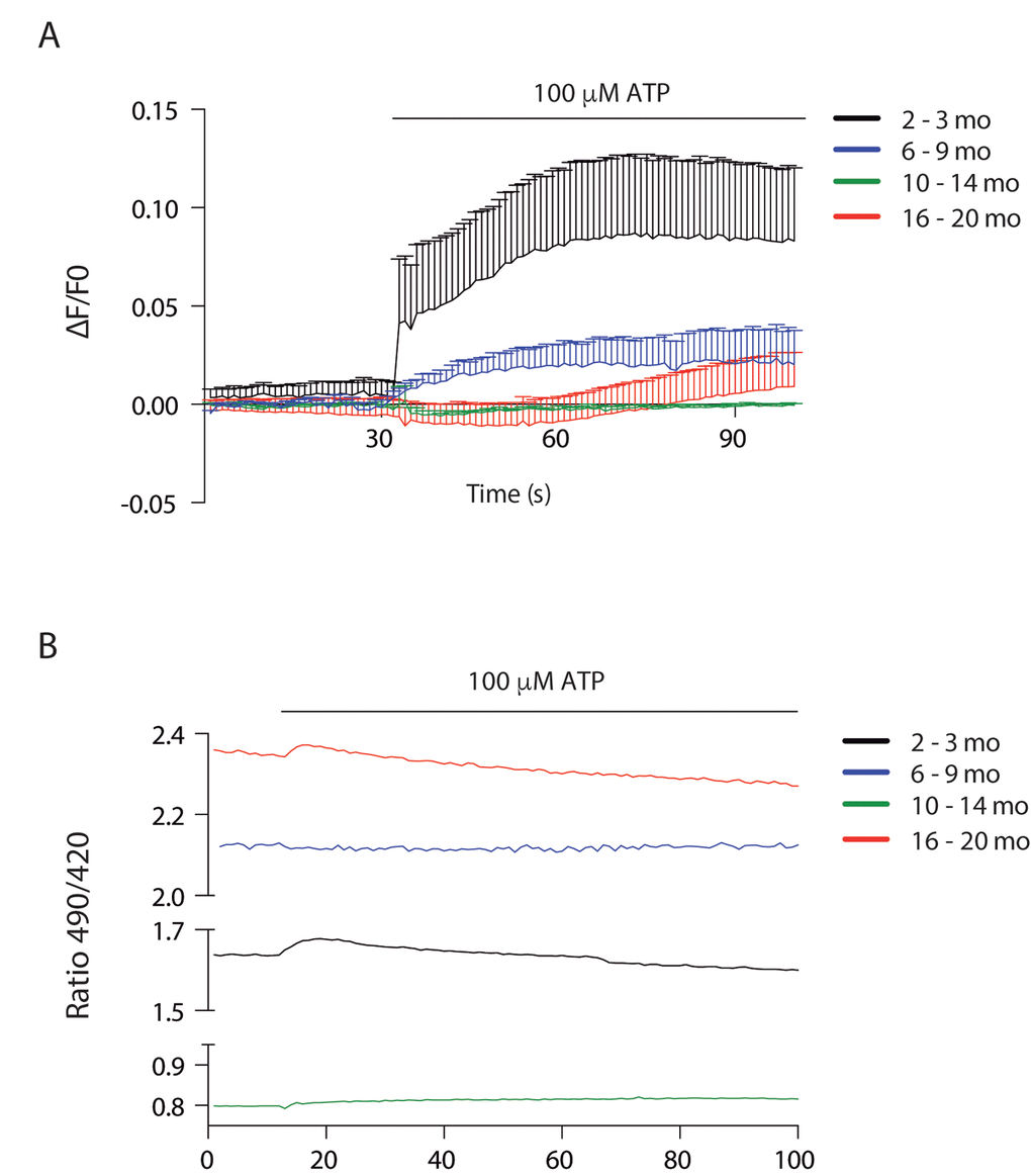 Cytosolic and mitochondrial Ca2+ transients differ according to age (A) Cytosolic Ca2+ peak transients are diminished in skeletal muscle fibers from adult and old mice. (B) Resting mitochondrial Ca2+ levels differ in the different stages of lifespan in mice. Mitopericam data are expressed as the 490/420 nm ratio. Upon ATP stimulation, mitochondrial Ca2+ transients were observed. We show representative traces of each age group.