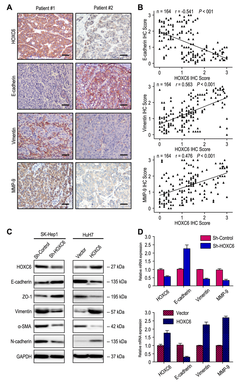 HOXC6 expression level correlated with the expression of epithelial-mesenchymal transition (EMT) markers. (A) Serial sections of human HCC tissue were subjected to IHC staining with antibodies against HOXC6, E-cadherin, Vimentin and MMP-9. In patient #1, high expression of HOXC6 in HCC tissues was accompanied by the absence of E-cadherin and elevated Vimentin, MMP-9. In patient #2, low expression of HOXC6 was accompanied by elevated E-cadherin and the absence of Vimentin, MMP-9. The scale bar represents 50 μm. (B) HOXC6 expression was negatively correlated with E-cadherin expression and positively associated with vimentin and MMP-9 expression. (C) Decreased expression of Vimentin, α-SMA and N-cadherin with increased expression of E-cadherin and ZO-1 in HOXC6-silenced cells compared with the control cells. An opposite expression pattern of these genes was observed in HOXC6-transfected cells. (D) The mRNA of E-cadherin was up-regulated, while the vimentin and MMP-9 was down-regulated, when HOXC6 was silenced. And opposite expression was observed in HOXC6-transfected cells.