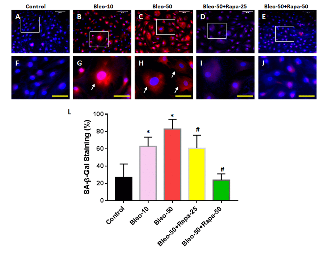 Senescence of rabbit AFSCs cultured in growth medium with five different conditions for 6 days and stained by immunostaining. (A, F) Growth medium only (Control); (B, G) bleomycin 10 μg/ml (Bleo-10); (C, H) bleomycin 50 μg/ml (Bleo-50); (D, I) Bleomycin 50 μg/ml and rapamycin 25 nM (Bleo-50 + Rapa-25); (E, J) Bleomycin 50 μg/ml and rapamycin 50 nM (Bleo-50 + Rapa-50); (L) Semi-quantification of positive stained AF cells grown in five different conditions for 6 days. The images of F, G, H, I, J were enlarged areas of the boxes in images of A, B, C, D, E. The results indicated that bleomycin treatment induced the senescence of AF cells which was stained by red fluorescence. Rapamycin decreased cell senescence induced by bleomycin. White bars: 100 μm, Yellow bars: 50 μm. *p