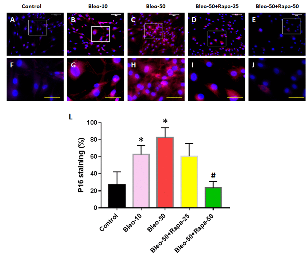 P16 expression in rabbit AFSCs cultured in growth medium with five different conditions for 6 days and stained by immunostaining. (A, F) Growth medium only (Control); (B, G) bleomycin 10 μg/ml (Bleo-10); (C, H) bleomycin 50 μg/ml (Bleo-50). (D, I) Bleomycin 50 μg/ml and rapamycin 25 nM (Bleo-50 + Rapa-25); (E, J) Bleomycin 50 μg/ml and rapamycin 50 nM (Bleo-50 + Rapa-50); (L) Semi-quantification of positive stained AF cells grown in five different concentrations for 6 days. The images of F, G, H, I, J were enlarged areas of the boxes in images of A, B, C, D, E. The results indicated that bleomycin treatment increased the expression of P16 in AF cells which was stained by red fluorescence. Rapamycin decreased P16 expression induced by bleomycin. White bars: 100 μm, Yellow bars: 50 μm. *p#P