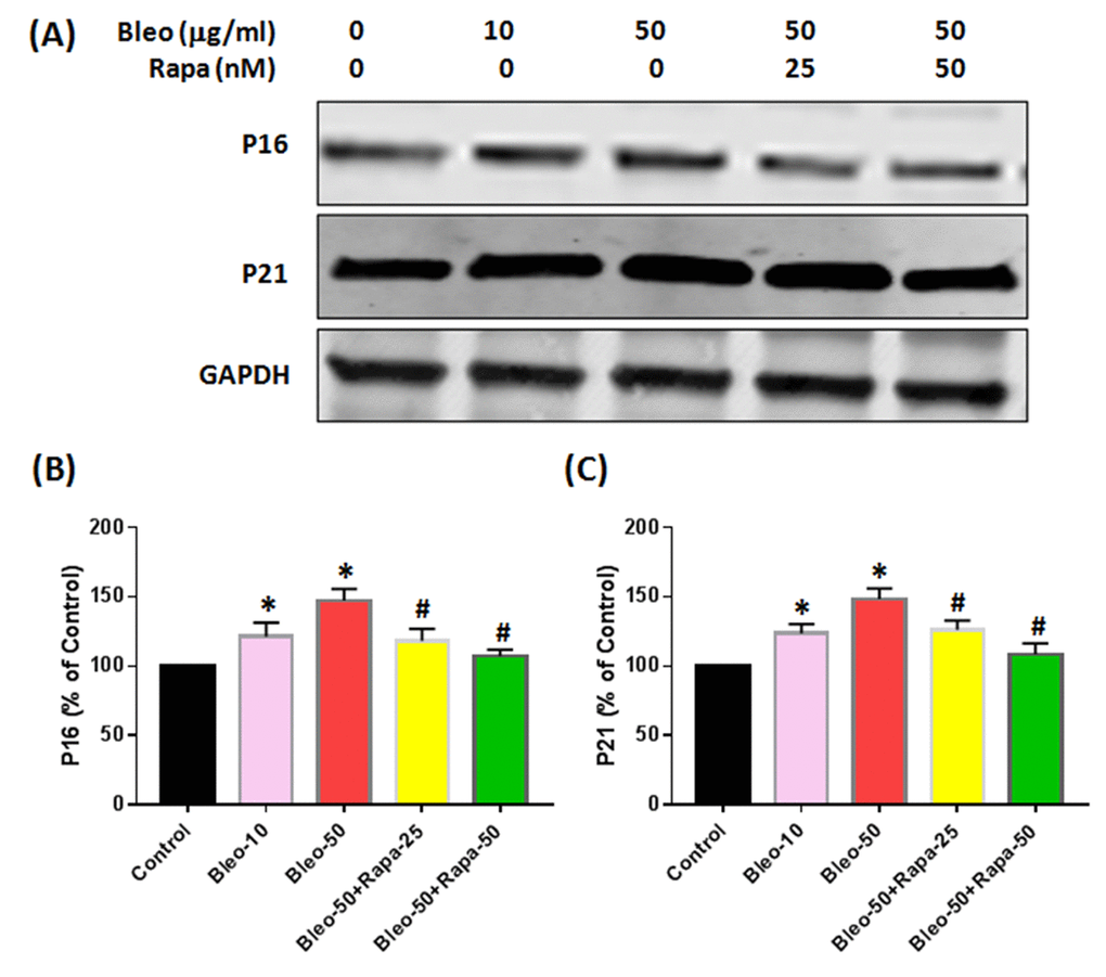 Protein expression of P16 and P21 in rabbit AFSCs cultured in growth medium with five different conditions for 6 days and tested by western blot. (A) Protein levels for P16, P21 and GAPDH; (B) semi-quantification of P16; (C) semi-quantification of P21. To ensure that equal amount of total protein was loaded, GAPDH (glyceraldehyde-3-phosphate dehydrogenase) was used as a loading control for protein normalization. The results indicated that bleomycin increased both P16 and P21 protein expression in AF cells with a concentration-dependent manner. Adding rapamycin in bleomycin treated AF cells decreased P16 and P21 levels in AF cells. *p#P