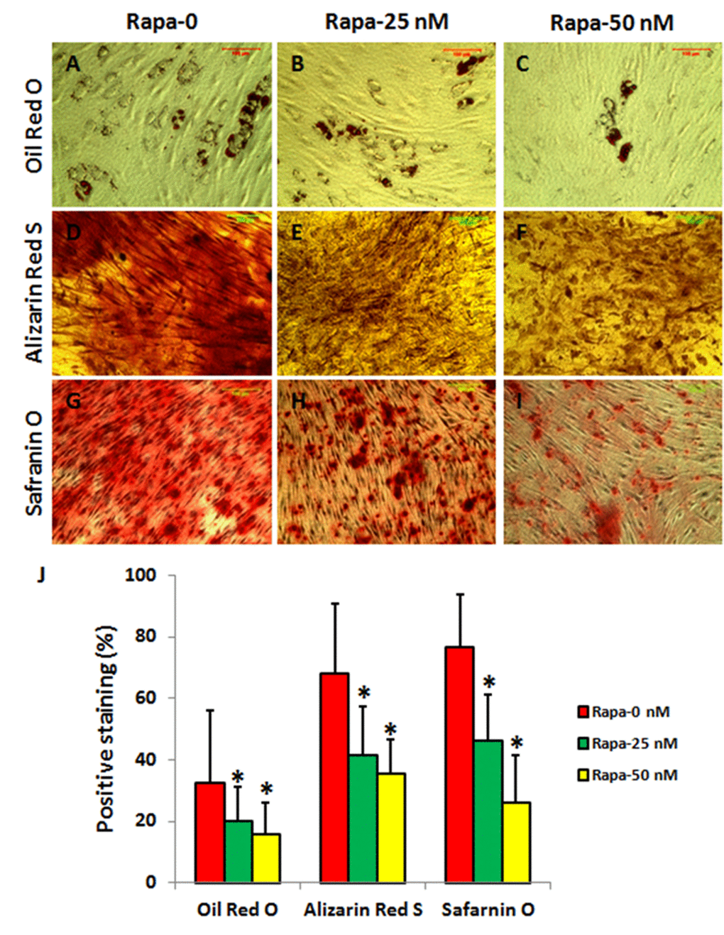 Rapamycin inhibited differentiation of rabbit AFSCs in a concentration-dependent manner (*P  The AFSCs were cultured in various differentiation media with rapamycin (0, 25, 50 nM) for 21 days. The adipocytes were stained by Oil Red O (A-C, J), osteocytes were stained by Alizarin Red S (D-F, J), and chondrocytes were stained by Safranin O (G-I, J), respectively. The differentiation potentials of AFSCs cultured with various conditions were analyzed by semi-quantification shown in (J).