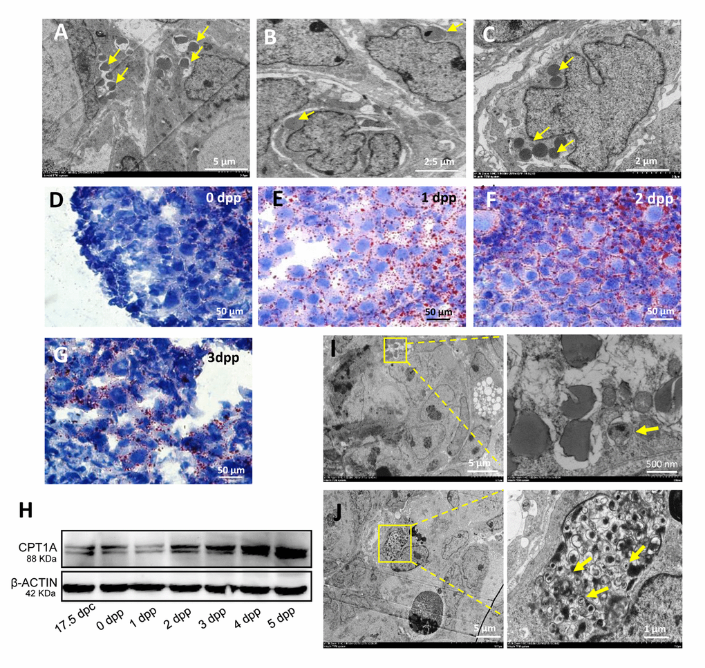 Characteristics of germ cell loss in mouse ovaries. (A) Observation of nuclear lipidation by TEM. (B) Observation of nuclear lipidation by TEM. (C) Observation of nuclear lipidation by TEM. (D-G) Oil red O staining of 0 dpp, 1 dpp, 2 dpp and 3 dpp, respectively. (H) WB detection for CPT1A in 17.5 dpc and 0 - 5 dpp ovaries. (I) Observation of nuclear lipidation with autophagosomes (frame) by TEM. (J) Observation of apoptosis with autophagosomes (frame) by TEM.