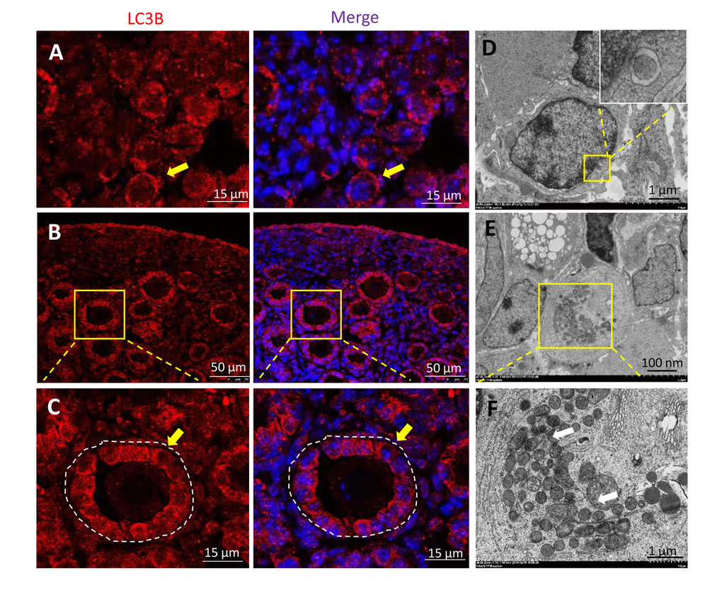 Transformation of LC3B expression in 1 and 3 dpp ovary. (A) IF staining for LC3B (red) in 1 dpp mouse ovaries. (B) IF staining for LC3B (red) in 3 dpp mouse ovaries. (C) IF staining for LC3B (red) in 3 dpp mouse ovaries. (D) Observation of typical autophagosomes in a granular cell within a follicle by TEM. (E-F) Observation of plenty mitochondria in an oocyte within follicle by TEM.