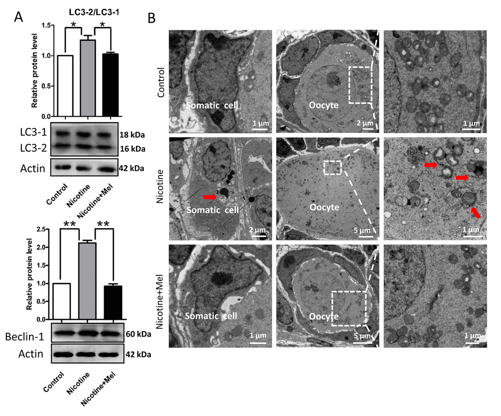 Melatonin suppresses autophagy in nicotine-exposed ovaries. (A) Protein level of LC3-2/LC3-1 and Beclin-1 in control, intraperitoneally injected 1 mg /kg nicotine and intraperitoneally injected 1 mg /kg nicotine plus 1 μM melatonin pups were detected by western blot. (B) Autophagosomes (arrow) in the somatic cell and oocyte cytoplasm in control, intraperitoneally injected 1 mg /kg nicotine and intraperitoneally injected 1 mg /kg nicotine plus 1 μM melatonin pups ovaries with TEM. The results are presented as mean±SD. All the experiments were repeated at least three times. * P 