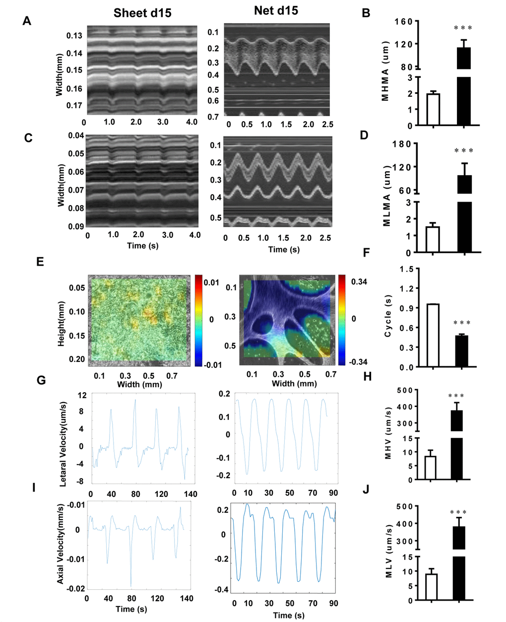 The motion analysis reveals significant physical differences among CMs with different shapes. (A and B) The MHMA of sheet-shaped CMs and net-shaped CMs; left panel: sheet-shaped CMs; right panel: net-shaped CMs. (C and D) The MLMA of sheet-shaped and net-shaped CMs; left panel: sheet-shaped CMs; right panel: net-shaped CMs. (E) The direction and velocity of two forms of hiPSC-CMs. Movement to the right is shown in red and to the left is shown in blue; deeper colors represent a greater velocity. (F) Movement cycles of the two forms of hiPSC-CMs. (G and H) The MHV of sheet-shaped and net-shaped CMs. (I and J) The MLV of sheet-shaped and net-shaped CMs; left panel: sheet-shaped CMs; right panel: net-shaped CMs. All data are expressed as means±S.E.M. * Statistically significant differences between individual groups (n≥3; *P