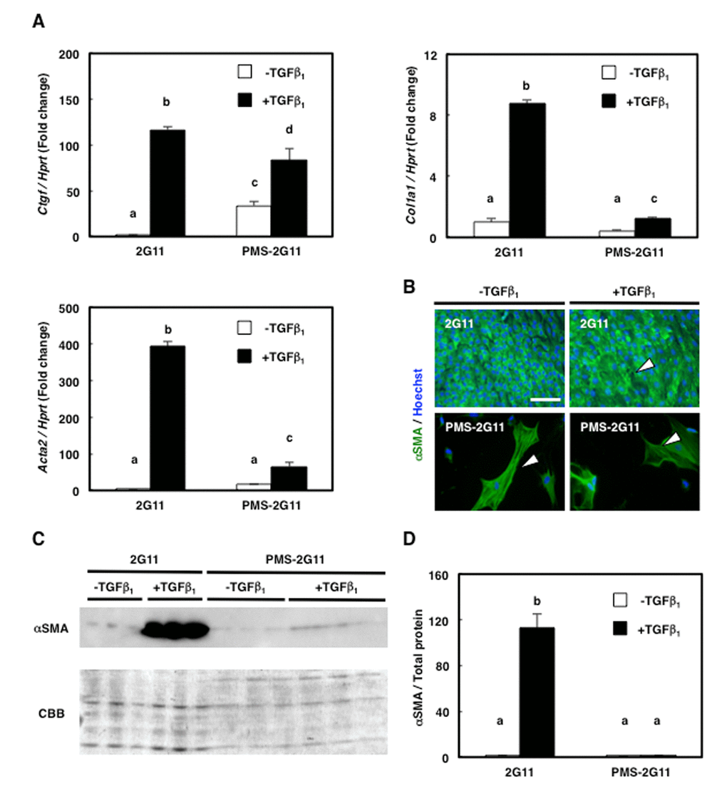 Fibrogenic differentiation ability was diminished in PMS-2G11 cells. (A) Quantification of mRNA levels of fibrosis-related markers in 2G11 and PMS-2G11 cells treated with or without TGFβ1. CTGF: connective-tissue growth factor; Col1a1: collagen type 1; Acta2: α-actin-2. Data are expressed as means±SE (n=3); distinct letters (a–d) indicate statistically significant differences (PB) Immunocytochemical analysis of α-smooth muscle actin expression in 2G11 and PMS-2G11 cells treated with or without TGFβ1. Arrowheads: stress fibres. Scale bar: 100 μm. (C) Immunoblotting analysis of α-smooth muscle actin expression in 2G11 and PMS-2G11 cells treated with or without TGFβ1. (D) Quantification of α-smooth muscle actin protein expression. Data are expressed as means±SE (n=3); distinct letters (a, b) indicate statistically significant differences (P