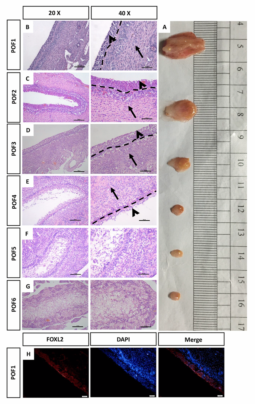 Morphology of the regressed POFs. (A) The removal of POFs (POF1-POF6). (B-G) HE staining was used to evaluate the morphology of POFs. The granulosa layer (arrowheads) and the theca layer (arrows) from POF1 to POF4 were separated by a dashed line. (These were indistinguishable in POF5 and POF6). Scale bars: 100 μm (20×) and 50 μm (40×). (H) Histological sections of POF1 were given an immunofluorescent label with granulosa cell marker FOXL2 (Red), where granulosa cells were mainly distributed in the granulosa layer. Scale bar: 50 μm.