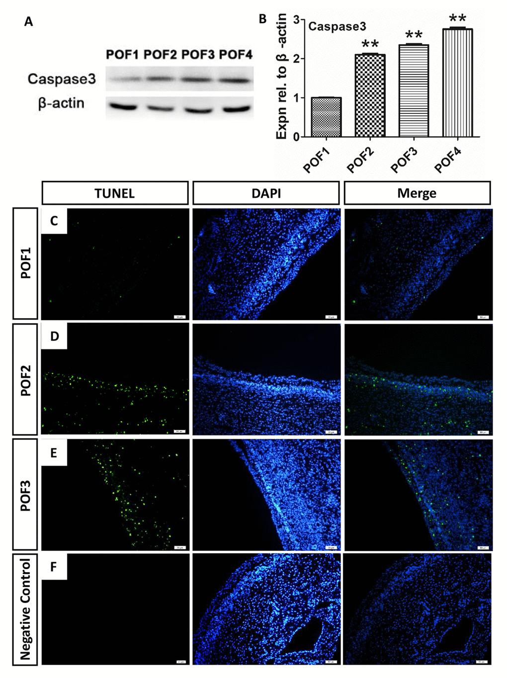 Caspase-induced apoptosis leads to POF degradation. (A-B) WB and grey analysis of caspase3 expression in POFs (POF1 to POF4). Values are means ± SEM of three experiments. Asterisks indicate significant differences (* PPB-E) Few TUNEL (green) marker labeled occurred in cells from POF1 to POF3. (D) Negative Control. Scale bar: 50 µm.