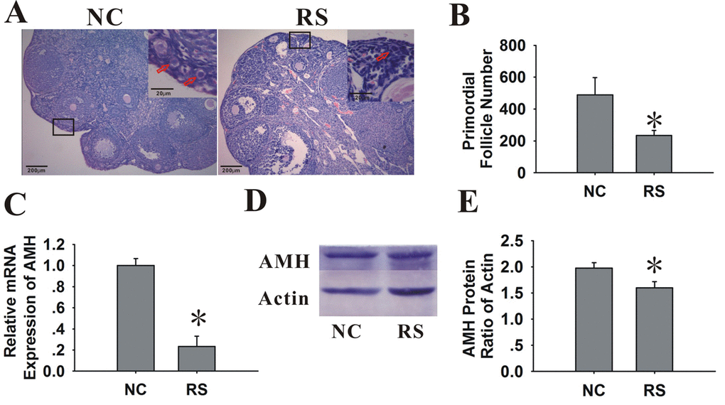 Effects of RS on the ovarian reserve of mice. (A) Photographs of the glass slides stained with HE in NC and RS mouse ovaries. Inset (upper right corner of each group) shows the number of primordial follicles (primordial follicles, red arrows). The images shown are at an original magnification of x200; insets are x400. (B) Bar graphs showed that the primordial follicle numbers of RS mice were significantly decreased compared to NC mice. (C) The mRNA expression of AMH decreased in RS mice. (D-E) The protein expression of AMH was determined using western blot analysis; bar graphs showed that the protein expression levels of AMH in RS mice were decreased compared to NC group.