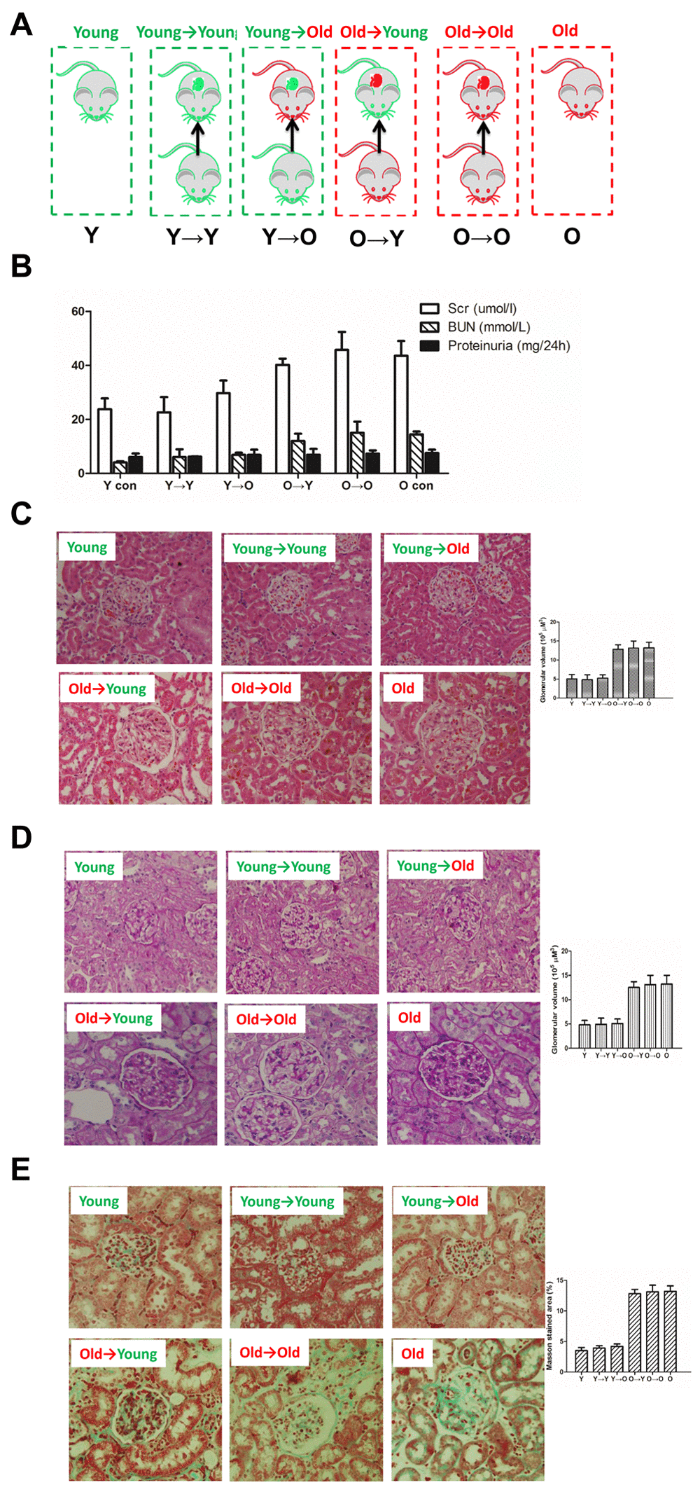 The histological examinations result from each group in this study. (A) Schematic diagram of kidney transplantation. Y→Y, young rat with kidney transplanted from young rat (young control); Y→O, old rat with kidney transplanted from young rat; O→Y, young rat with kidney transplanted from old rat; O→O, old rat with kidney transplanted from old rat (old control). (B) Renal functionality (serum creatinine, serum BUN, proteinurine) in each group. (C) HE staining of kidney tissue samples from each group (×200). (D) PAS staining of kidney tissue samples from each group (×200). (E) Masson staining of kidney tissue samples from each group (×200);