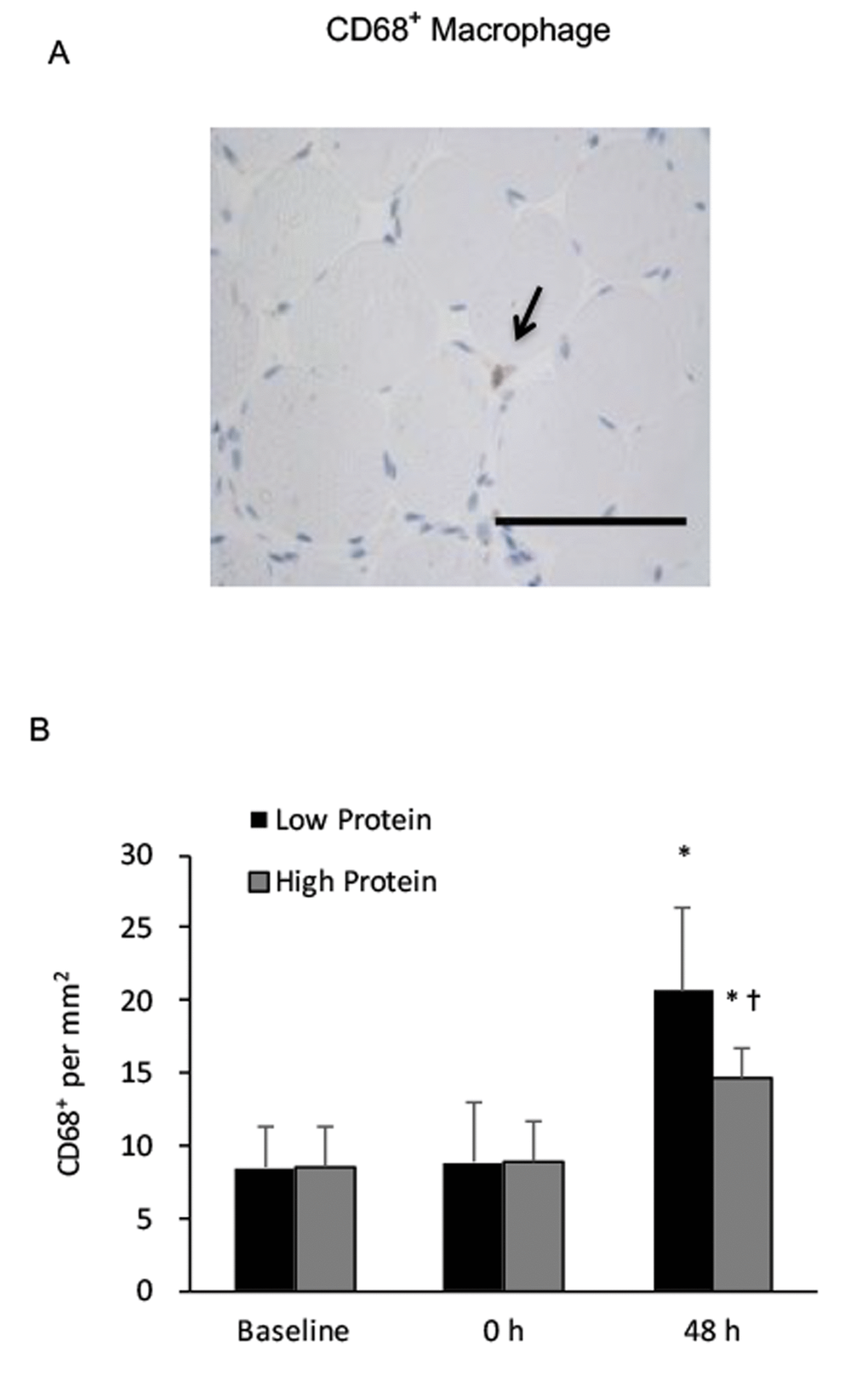 Phagocytic macrophage (CD68+) in human skeletal muscle after resistance exercise. (A) Representative immunohistochemical staining of a muscle cross-section (CD68+ macrophage indicated by an arrow). Scale bar 100 μm. (B) Low protein supplementation before and after resistance exercise enhanced CD68+ macrophage infiltration in skeletal muscle above High protein trial. * Significant difference against Baseline, P 