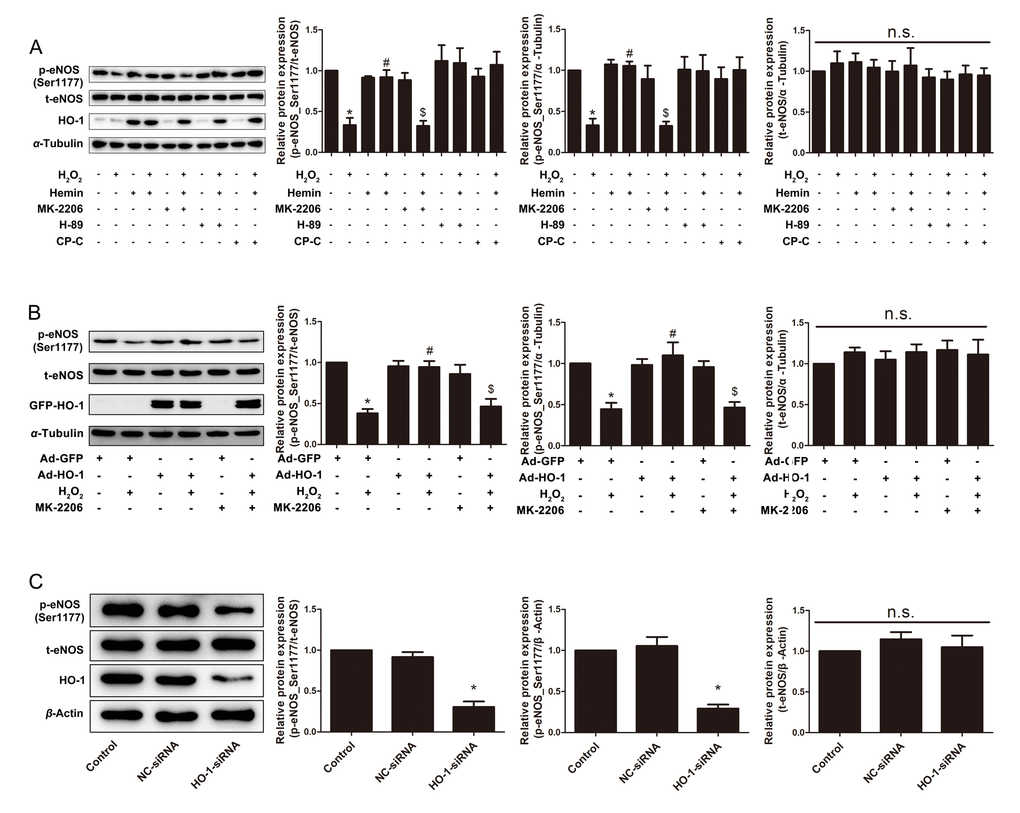 HO-1 retarded H2O2-induced HUVEC senescence through eNOS activation via Akt. (A) Expressions of p-eNOS(Ser1177) and total eNOS were measured in HUVECs treated with or without H2O2 and Hemin in the presence or absence of Akt inhibitor MK-2206, PKA inhibitor H-89 or AMPK inhibitor Compound C (CP-C). *P #P 2O2; $P 2O2+Hemin; n.s., non significant. n = 5. (B) Expressions of p-eNOS(Ser1177) and total eNOS were measured in HUVECs infected with or without HO-1 recombinant adenovirus in the presence or absence of Akt inhibitor MK-2206. *P #P 2O2; $P 2O2; n.s., non significant. n = 5. (C) Expressions of p-eNOS(Ser1177) and total eNOS were measured in HUVECs transfected with or without HO-1 siRNA. *P 