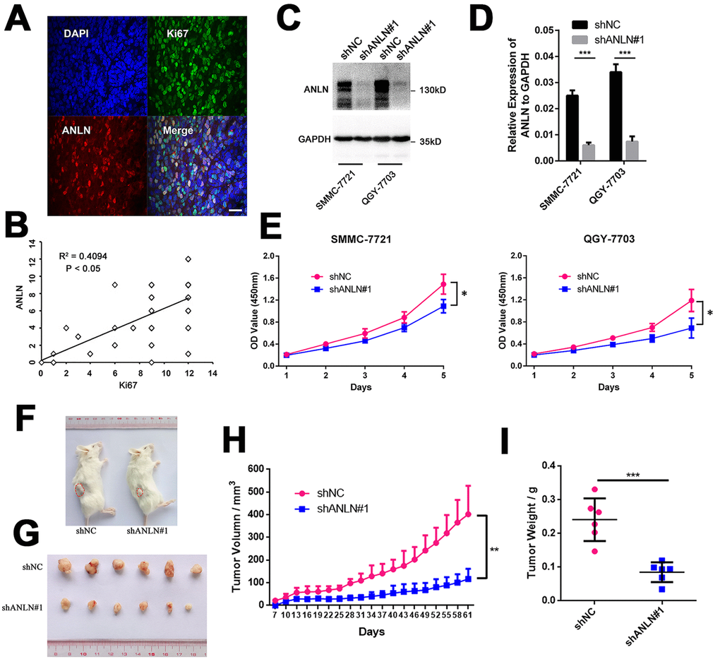 ANLN expression is associated with HCC cell viability. (A) Representative image of the immunofluorescence analysis of ANLN and Ki67 expressions in HCC tissue. (B) Correlation analysis of IHC staining scores for ANLN and Ki67 expressions in 53 HCC slices. (C) Western blotting analysis of the knockdown efficacy of ANLN shRNA in SMMC-7721 and QGY-7703 cells. (D) Q-PCR analysis of the efficacy of ANLN shRNA in SMMC-7721 and QGY-7703 cells. (E) Viability of SMMC-7721 and QGY-7703 cells after ANLN depletion was assessed by MTT assay at indicated times. (F) Representative image of NSI mice injected with control and ANLN knockdown SMMC-7721 cells. The red dashed line depicts the border of palpable xenograft tumors. (G) All tumors isolated from NSI mice are shown. (H-I) Growth curves (H) and weights (I) of xenograft tumors from NSI mice injected with control and ANLN knockdown SMMC-7721 cells. Changes in tumor volumes measured on the indicated days are shown. *P 